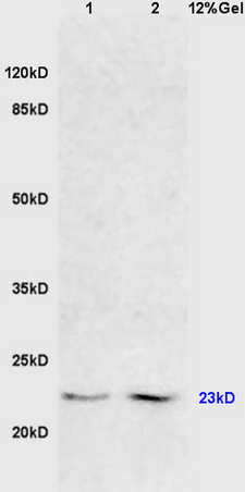 L1 mouse liver lysates, L2 mouse brain lysates probed with Anti FADD Polyclonal Antibody, Unconjugated (bs-0511R) at 1:200 in 4˚C. Followed by conjugation to secondary antibody (bs-0295G-HRP) at 1:3000 90min in 37˚C. Predicted band and observed band size: 23kD
