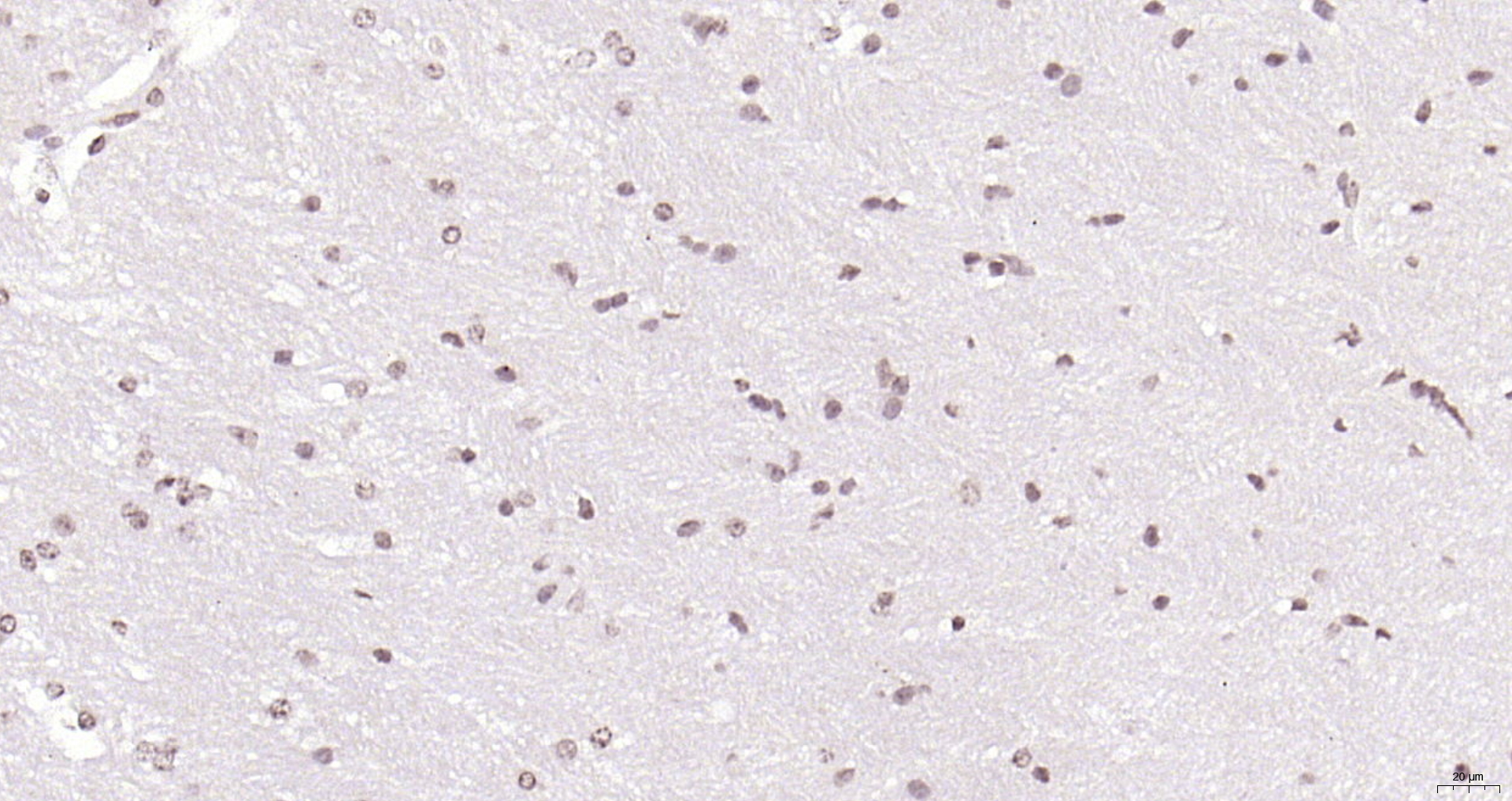 Paraformaldehyde-fixed, paraffin embedded (mouse brain); Antigen retrieval by boiling in sodium citrate buffer (pH6.0) for 15min; Block endogenous peroxidase by 3% hydrogen peroxide for 20 minutes; Blocking buffer (normal goat serum) at 37°C for 30min; Antibody incubation with (SOX4) Polyclonal Antibody, Unconjugated (bs-11208R) at 1:200 overnight at 4°C, followed by operating according to SP Kit(Rabbit) (sp-0023) instructionsand DAB staining.