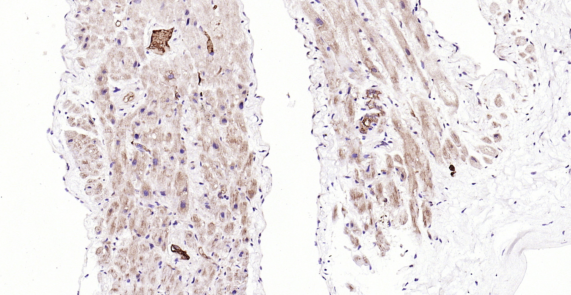 Paraformaldehyde-fixed, paraffin embedded (human myocardium); Antigen retrieval by boiling in sodium citrate buffer (pH6.0) for 15min; Block endogenous peroxidase by 3% hydrogen peroxide for 20 minutes; Blocking buffer (normal goat serum) at 37°C for 30min; Antibody incubation with (PDK4) Polyclonal Antibody, Unconjugated (bs-0682R) at 1:200 overnight at 4°C, followed by operating according to SP Kit(Rabbit) (sp-0023) instructionsand DAB staining.