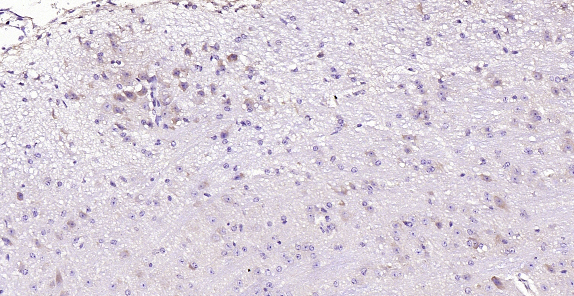 Paraformaldehyde-fixed, paraffin embedded (mouse brain); Antigen retrieval by boiling in sodium citrate buffer (pH6.0) for 15min; Block endogenous peroxidase by 3% hydrogen peroxide for 20 minutes; Blocking buffer (normal goat serum) at 37°C for 30min; Antibody incubation with (PDK4) Polyclonal Antibody, Unconjugated (bs-0682R) at 1:200 overnight at 4°C, followed by operating according to SP Kit(Rabbit) (sp-0023) instructionsand DAB staining.