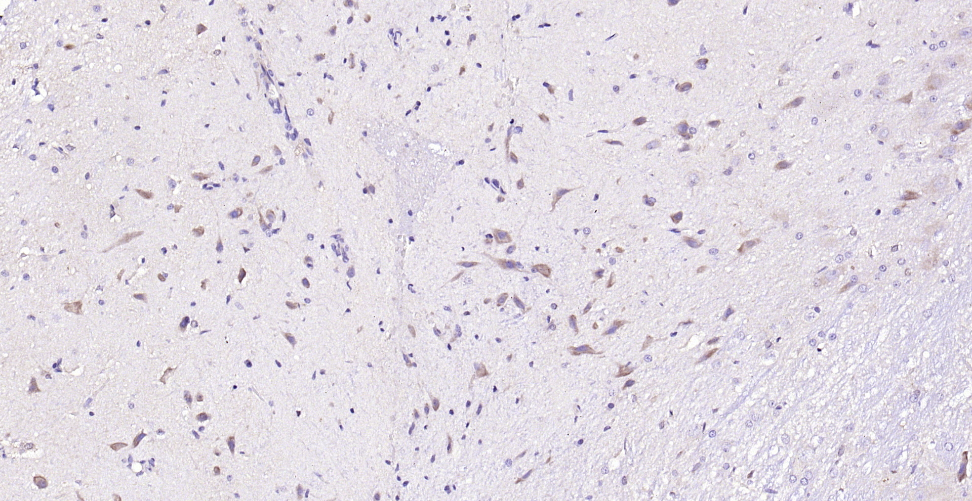 Paraformaldehyde-fixed, paraffin embedded (rat brain); Antigen retrieval by boiling in sodium citrate buffer (pH6.0) for 15min; Block endogenous peroxidase by 3% hydrogen peroxide for 20 minutes; Blocking buffer (normal goat serum) at 37°C for 30min; Antibody incubation with (PDK4) Polyclonal Antibody, Unconjugated (bs-0682R) at 1:200 overnight at 4°C, followed by operating according to SP Kit(Rabbit) (sp-0023) instructionsand DAB staining.