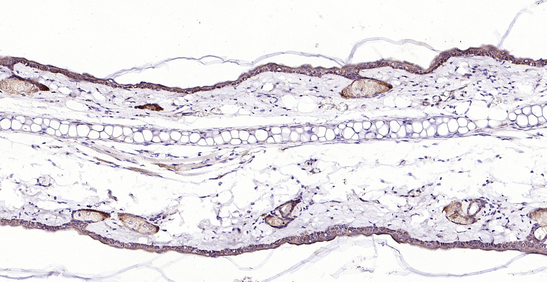 Paraformaldehyde-fixed, paraffin embedded (rat skin); Antigen retrieval by boiling in sodium citrate buffer (pH6.0) for 15min; Block endogenous peroxidase by 3% hydrogen peroxide for 20 minutes; Blocking buffer (normal goat serum) at 37°C for 30min; Antibody incubation with (ECM1) Polyclonal Antibody, Unconjugated (bs-0776R) at 1:200 overnight at 4°C, followed by operating according to SP Kit(Rabbit) (sp-0023) instructionsand DAB staining.