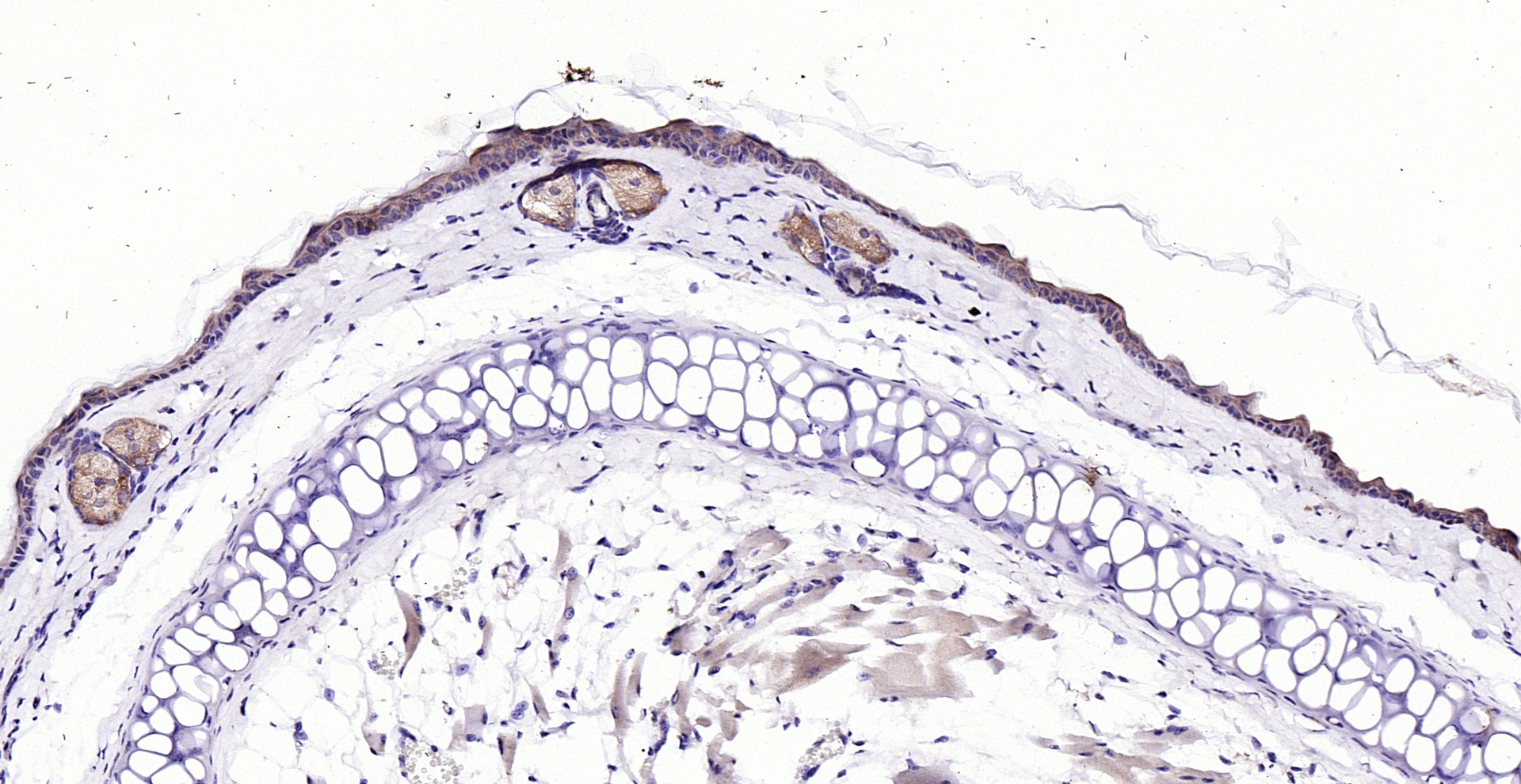 Paraformaldehyde-fixed, paraffin embedded (mouset skin); Antigen retrieval by boiling in sodium citrate buffer (pH6.0) for 15min; Block endogenous peroxidase by 3% hydrogen peroxide for 20 minutes; Blocking buffer (normal goat serum) at 37°C for 30min; Antibody incubation with (ECM1) Polyclonal Antibody, Unconjugated (bs-0776R) at 1:200 overnight at 4°C, followed by operating according to SP Kit(Rabbit) (sp-0023) instructionsand DAB staining.
