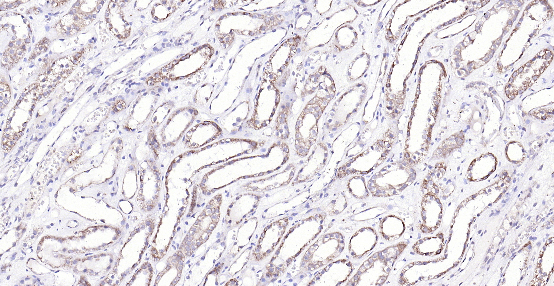 Paraformaldehyde-fixed, paraffin embedded (human kidney); Antigen retrieval by boiling in sodium citrate buffer (pH6.0) for 15min; Block endogenous peroxidase by 3% hydrogen peroxide for 20 minutes; Blocking buffer (normal goat serum) at 37°C for 30min; Antibody incubation with (ECM1) Polyclonal Antibody, Unconjugated (bs-0776R) at 1:200 overnight at 4°C, followed by operating according to SP Kit(Rabbit) (sp-0023) instructionsand DAB staining.