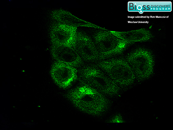 KLN 205 cells labeled with Rabbit HIF-1 Alpha Polyclonal Antibody Polyclonal Antibody, Unconjugated (bs-0737R) followed by a FITC Conjugated Secondary Antibody.