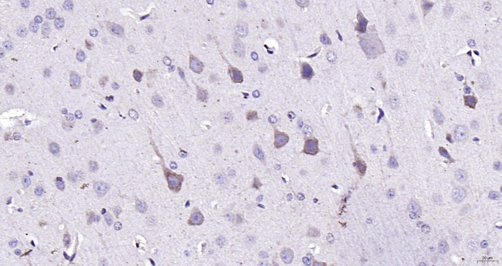 Paraformaldehyde-fixed, paraffin embedded (rat brain); Antigen retrieval by boiling in sodium citrate buffer (pH6.0) for 15min; Block endogenous peroxidase by 3% hydrogen peroxide for 20 minutes; Blocking buffer (normal goat serum) at 37°C for 30min; Antibody incubation with (LPA3) Polyclonal Antibody, Unconjugated (bs-2882R) at 1:200 overnight at 4°C, followed by operating according to SP Kit(Rabbit) (sp-0023) instructionsand DAB staining.