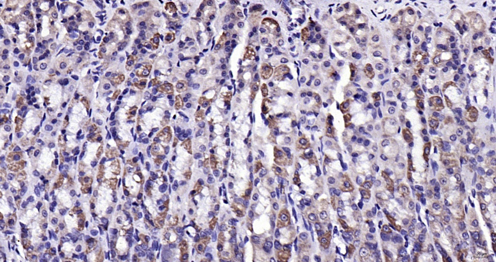 Paraformaldehyde-fixed, paraffin embedded (mouse stomach); Antigen retrieval by boiling in sodium citrate buffer (pH6.0) for 15min; Block endogenous peroxidase by 3% hydrogen peroxide for 20 minutes; Blocking buffer (normal goat serum) at 37°C for 30min; Antibody incubation with (LPA2) Polyclonal Antibody, Unconjugated (bs-10368R) at 1:200 overnight at 4°C, followed by operating according to SP Kit(Rabbit) (sp-0023) instructionsand DAB staining.