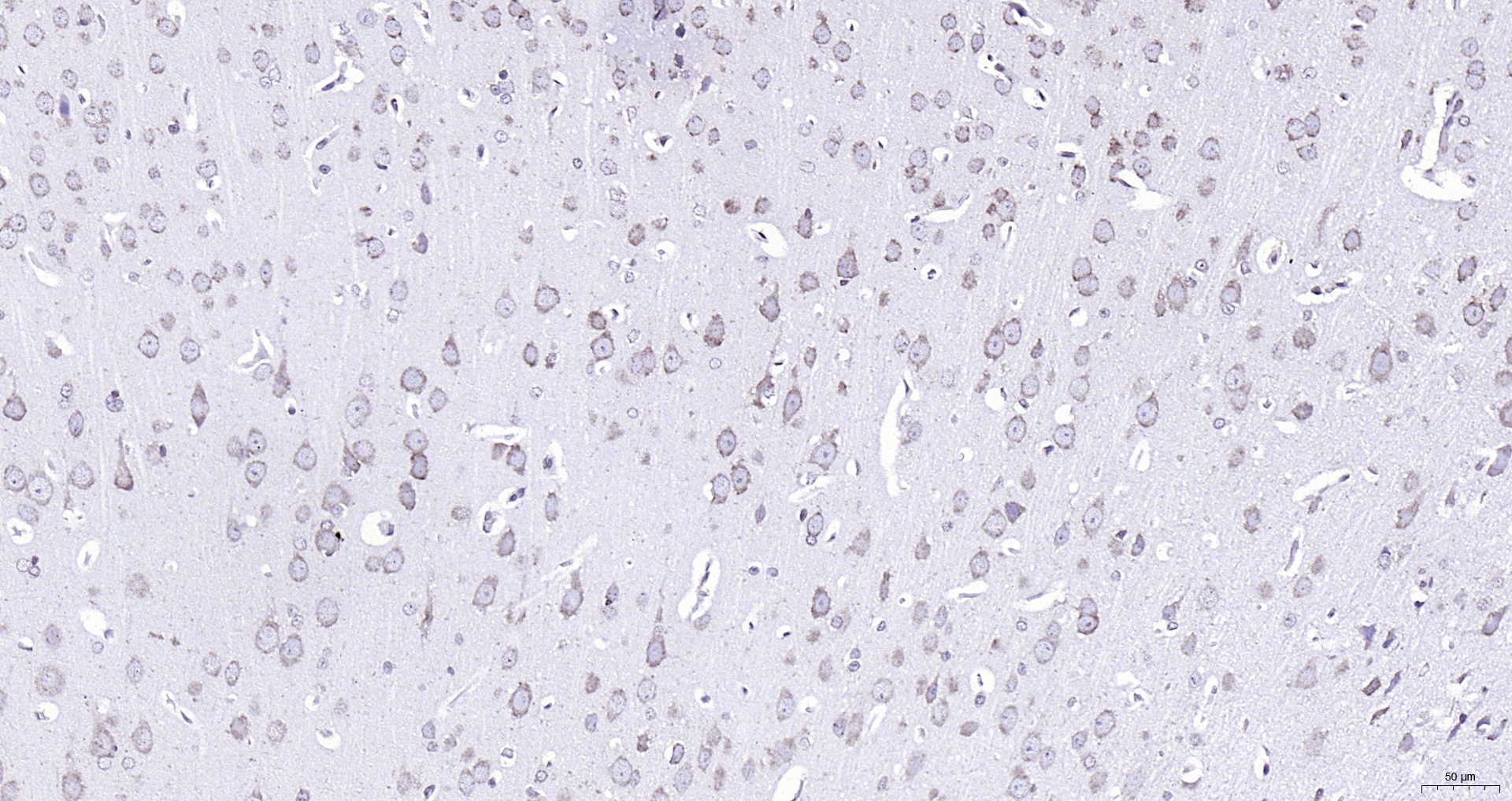 Paraformaldehyde-fixed, paraffin embedded (rat brain); Antigen retrieval by boiling in sodium citrate buffer (pH6.0) for 15min; Block endogenous peroxidase by 3% hydrogen peroxide for 20 minutes; Blocking buffer (normal goat serum) at 37°C for 30min; Antibody incubation with (GRP94) Polyclonal Antibody, Unconjugated (bs-0194R) at 1:200 overnight at 4°C, followed by operating according to SP Kit(Rabbit) (sp-0023) instructionsand DAB staining.