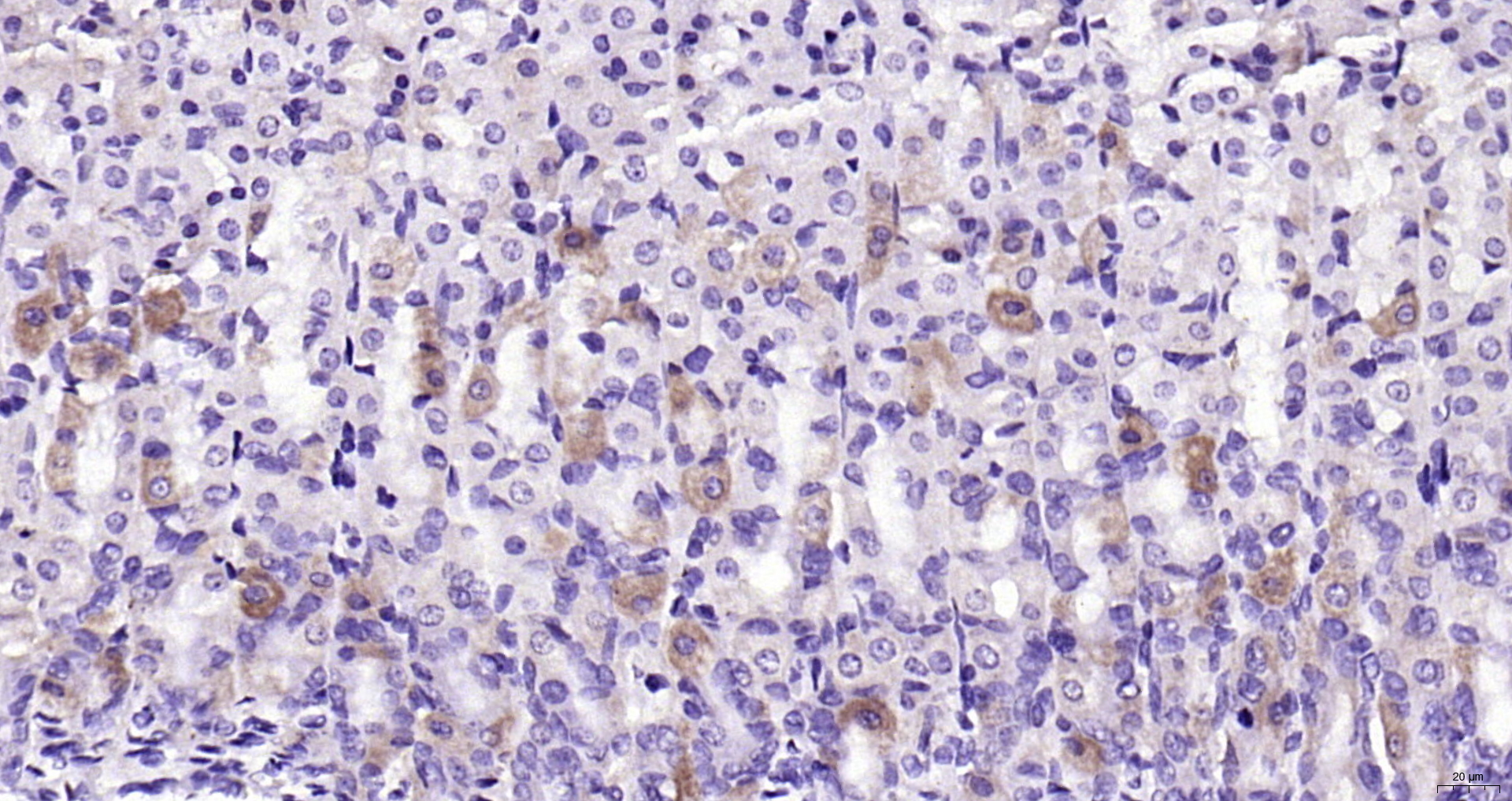 Paraformaldehyde-fixed, paraffin embedded (rat stomach); Antigen retrieval by boiling in sodium citrate buffer (pH6.0) for 15min; Block endogenous peroxidase by 3% hydrogen peroxide for 20 minutes; Blocking buffer (normal goat serum) at 37°C for 30min; Antibody incubation with (KLHL9) Polyclonal Antibody, Unconjugated (bs-7753R) at 1:200 overnight at 4°C, followed by operating according to SP Kit(Rabbit) (sp-0023) instructionsand DAB staining.