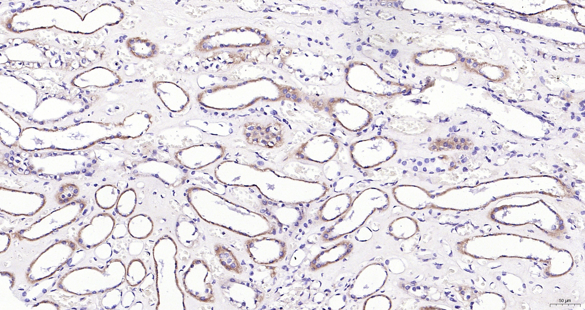 Paraformaldehyde-fixed, paraffin embedded (Human kidney); Antigen retrieval by boiling in sodium citrate buffer (pH6.0) for 15min; Block endogenous peroxidase by 3% hydrogen peroxide for 20 minutes; Blocking buffer (normal goat serum) at 37°C for 30min; Antibody incubation with (CRIPTO) Polyclonal Antibody, Unconjugated (bs-1566R) at 1:200 overnight at 4°C, followed by operating according to SP Kit(Rabbit) (sp-0023) instructionsand DAB staining.