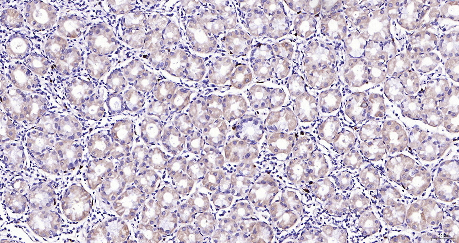 Paraformaldehyde-fixed, paraffin embedded (Human stomach); Antigen retrieval by boiling in sodium citrate buffer (pH6.0) for 15min; Block endogenous peroxidase by 3% hydrogen peroxide for 20 minutes; Blocking buffer (normal goat serum) at 37°C for 30min; Antibody incubation with (CRIPTO) Polyclonal Antibody, Unconjugated (bs-1566R) at 1:200 overnight at 4°C, followed by operating according to SP Kit(Rabbit) (sp-0023) instructionsand DAB staining.