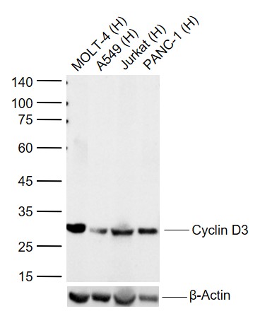Lane 1: Human MOLT-4 cell lysates; Lane 2: Human A549 cell lysates; Lane 3: Human Jurkat cell lysates; Lane 4: Human Panc-1 cell lysates probed with Cyclin D3 Monoclonal Antibody, Unconjugated (bsm-52047R) at 1:1000 dilution and 4\u00b0C overnight incubation. Followed by conjugated secondary antibody incubation at 1:20000 for 60 min at 37˚C.
