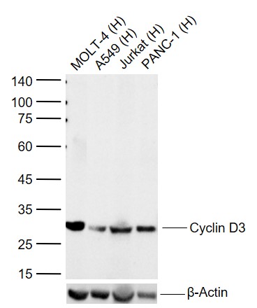 Lane 1: Human MOLT-4 cell lysates; Lane 2: Human A549 cell lysates; Lane 3: Human Jurkat cell lysates; Lane 4: Human Panc-1 cell lysates probed with Cyclin D3 Monoclonal Antibody, Unconjugated (bsm-52047R) at 1:1000 dilution and 4°C overnight incubation. Followed by conjugated secondary antibody incubation at 1:20000 for 60 min at 37˚C.