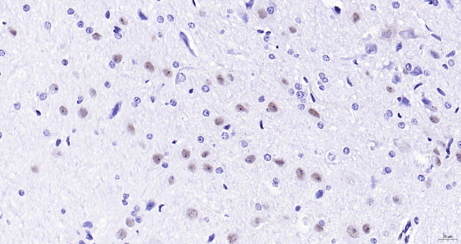Paraformaldehyde-fixed, paraffin embedded (rat brain); Antigen retrieval by boiling in sodium citrate buffer (pH6.0) for 15min; Block endogenous peroxidase by 3% hydrogen peroxide for 20 minutes; Blocking buffer (normal goat serum) at 37°C for 30min; Antibody incubation with (Nova1) Polyclonal Antibody, Unconjugated (bs-11324R) at 1:200 overnight at 4°C, followed by operating according to SP Kit(Rabbit) (sp-0023) instructionsand DAB staining.