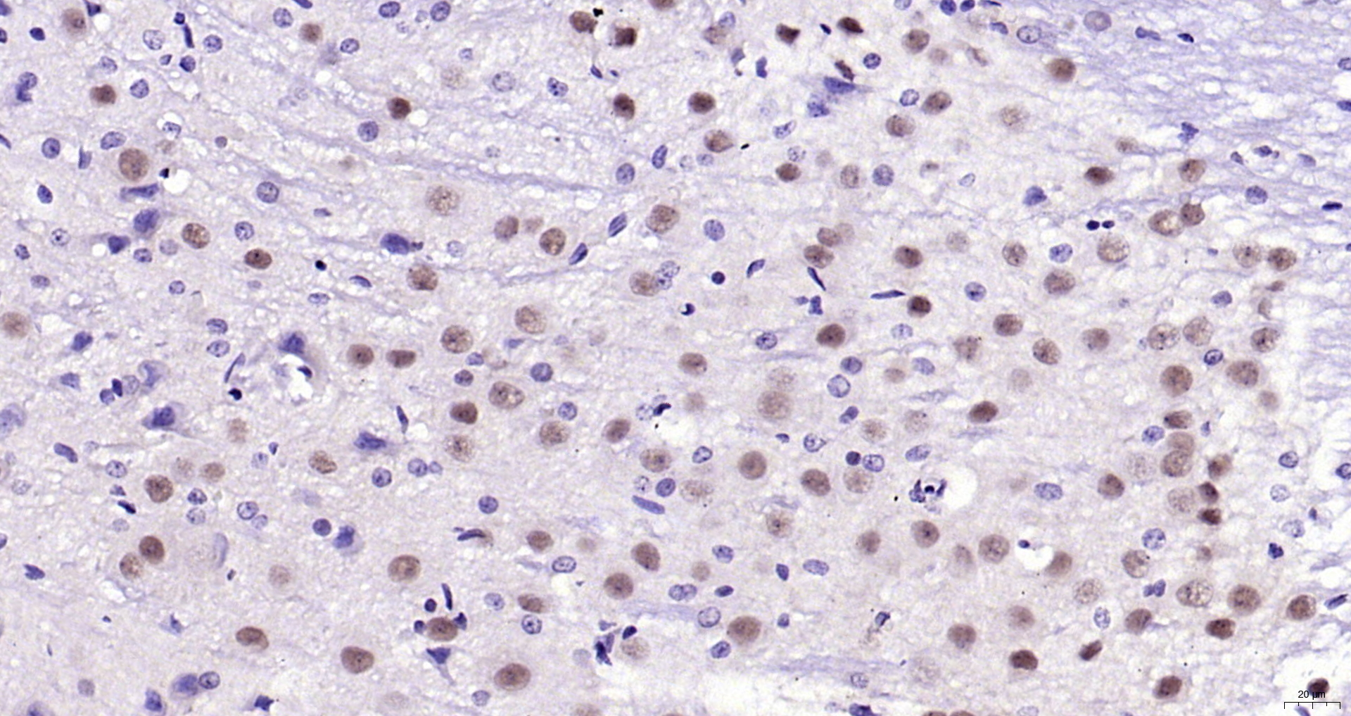 Paraformaldehyde-fixed, paraffin embedded (rat cerebellum); Antigen retrieval by boiling in sodium citrate buffer (pH6.0) for 15min; Block endogenous peroxidase by 3% hydrogen peroxide for 20 minutes; Blocking buffer (normal goat serum) at 37°C for 30min; Antibody incubation with (Nova1) Polyclonal Antibody, Unconjugated (bs-11324R) at 1:200 overnight at 4°C, followed by operating according to SP Kit(Rabbit) (sp-0023) instructionsand DAB staining.