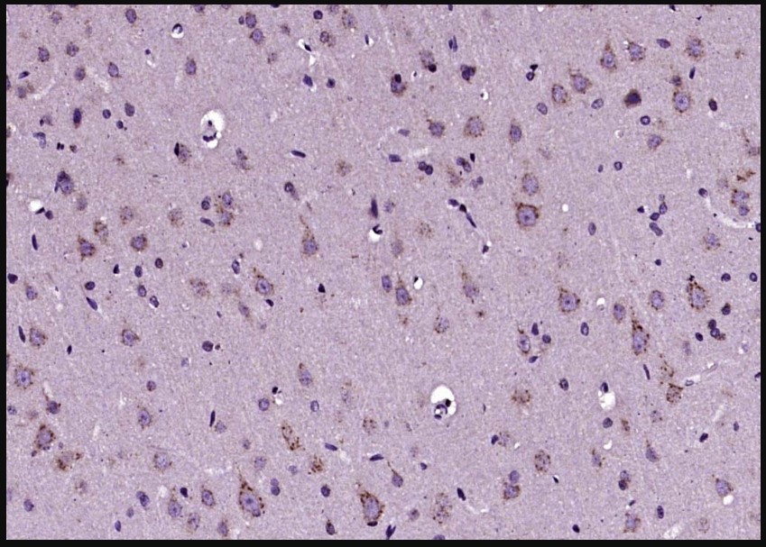 Paraformaldehyde-fixed, paraffin-embedded (Rat brain); Antigen retrieval by boiling in sodium citrate buffer (pH6.0) for 15min; Block endogenous peroxidase by 3% hydrogen peroxide for 20 minutes; Blocking buffer (normal goat serum) at 37°C for 30min; Antibody incubation with (GPR39) Polyclonal Antibody, Unconjugated (bs-5789R) at 1:400 overnight at 4°C, followed by operating according to SP Kit(Rabbit) (sp-0023) instructions and DAB staining.