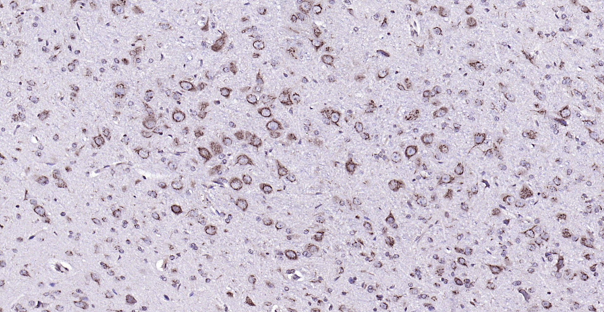 Paraformaldehyde-fixed, paraffin embedded (rat brain); Antigen retrieval by boiling in sodium citrate buffer (pH6.0) for 15min; Block endogenous peroxidase by 3% hydrogen peroxide for 20 minutes; Blocking buffer (normal goat serum) at 37°C for 30min; Antibody incubation with (phospho-MST4 + MST3 + STK25 (Thr178 + Thr190 + Thr174) ) Polyclonal Antibody, Unconjugated (bs-10441R) at 1:200 overnight at 4°C, followed by operating according to SP Kit(Rabbit) (sp-0023) instructionsand DAB staining.