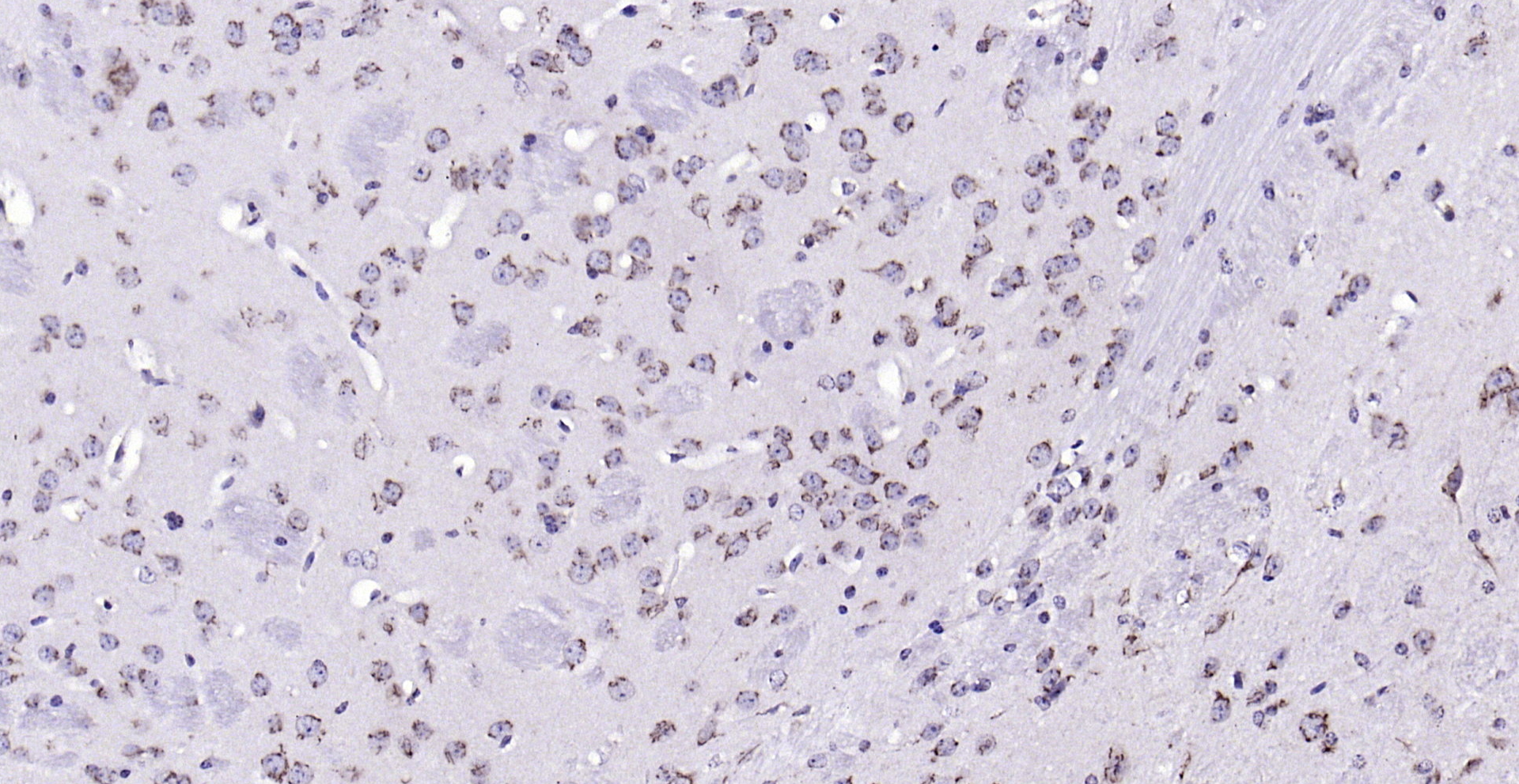 Paraformaldehyde-fixed, paraffin embedded (mouse brain); Antigen retrieval by boiling in sodium citrate buffer (pH6.0) for 15min; Block endogenous peroxidase by 3% hydrogen peroxide for 20 minutes; Blocking buffer (normal goat serum) at 37°C for 30min; Antibody incubation with (phospho-MST4 + MST3 + STK25 (Thr178 + Thr190 + Thr174) ) Polyclonal Antibody, Unconjugated (bs-10441R) at 1:200 overnight at 4°C, followed by operating according to SP Kit(Rabbit) (sp-0023) instructionsand DAB staining.