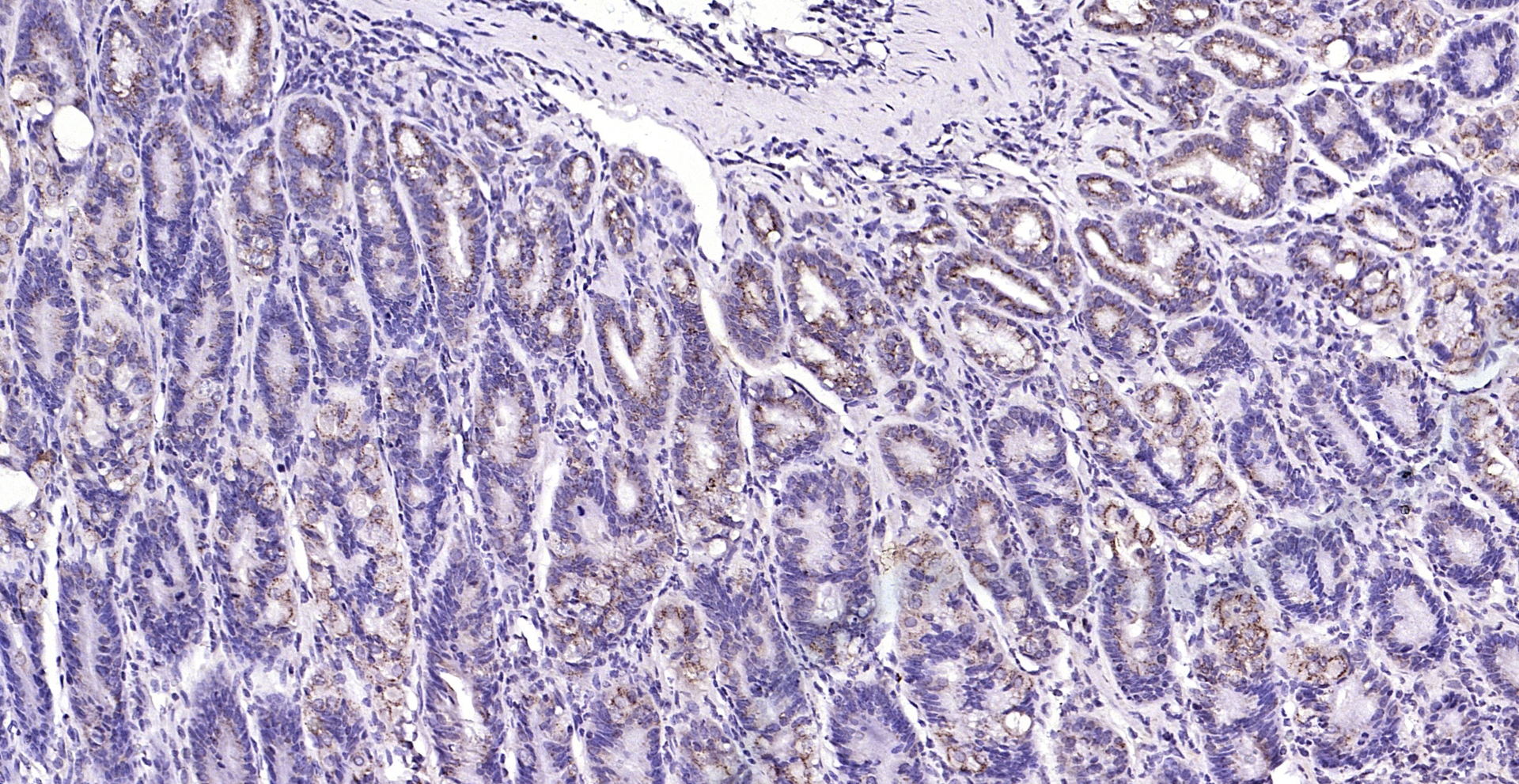 Paraformaldehyde-fixed, paraffin embedded (mouse stomach); Antigen retrieval by boiling in sodium citrate buffer (pH6.0) for 15min; Block endogenous peroxidase by 3% hydrogen peroxide for 20 minutes; Blocking buffer (normal goat serum) at 37°C for 30min; Antibody incubation with (phospho-MST4 + MST3 + STK25 (Thr178 + Thr190 + Thr174) ) Polyclonal Antibody, Unconjugated (bs-10441R) at 1:200 overnight at 4°C, followed by operating according to SP Kit(Rabbit) (sp-0023) instructionsand DAB staining.