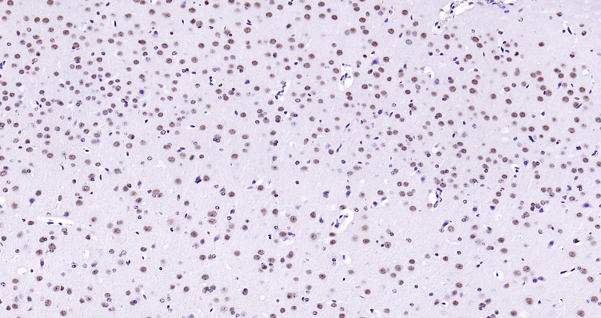 Paraformaldehyde-fixed, paraffin embedded (mouse brain); Antigen retrieval by boiling in sodium citrate buffer (pH6.0) for 15min; Block endogenous peroxidase by 3% hydrogen peroxide for 20 minutes; Blocking buffer (normal goat serum) at 37°C for 30min; Antibody incubation with (LMX1b) Polyclonal Antibody, Unconjugated (bs-11780R) at 1:200 overnight at 4°C, followed by operating according to SP Kit(Rabbit) (sp-0023) instructionsand DAB staining.