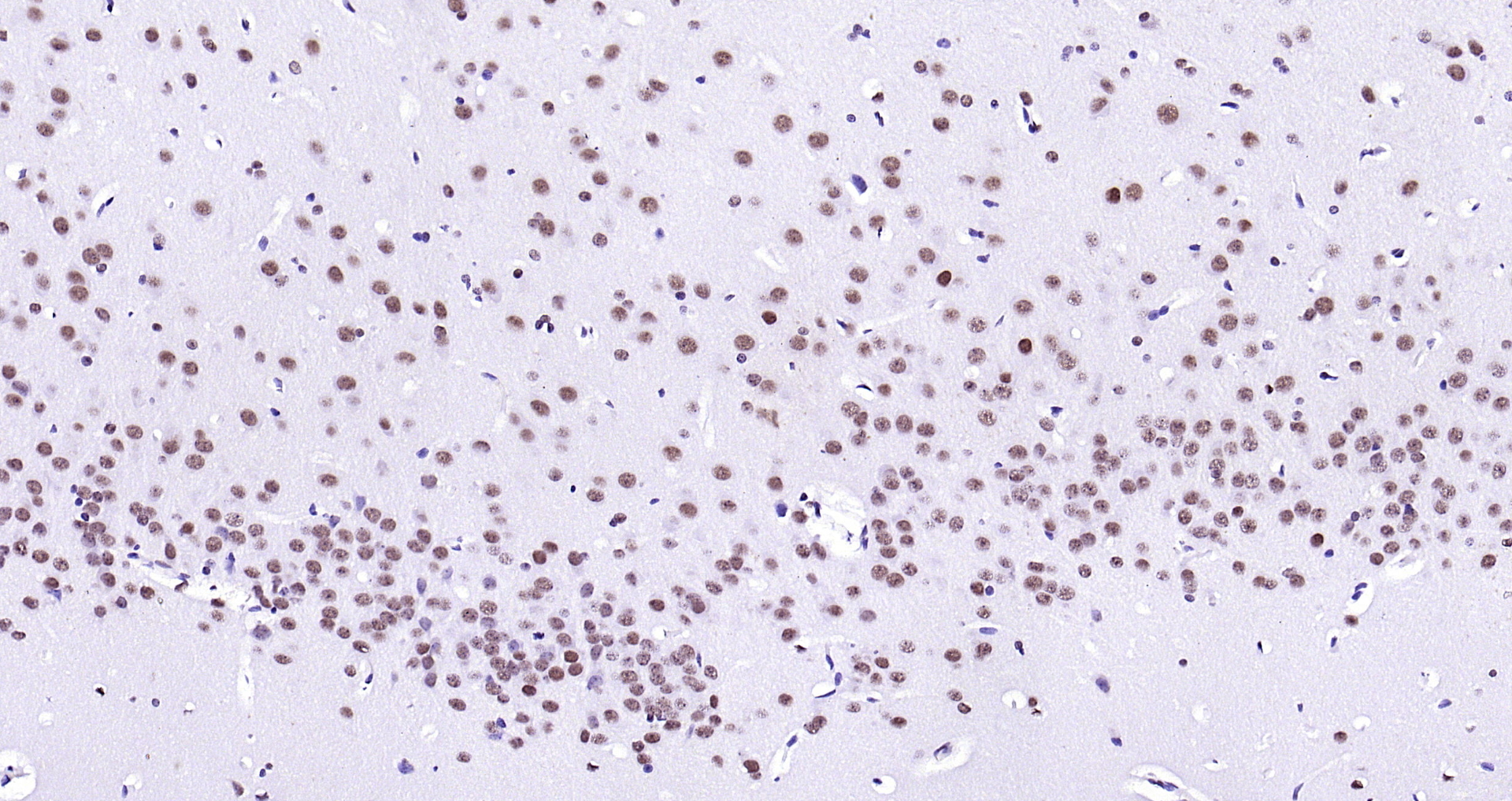 Paraformaldehyde-fixed, paraffin embedded (rat brain); Antigen retrieval by boiling in sodium citrate buffer (pH6.0) for 15min; Block endogenous peroxidase by 3% hydrogen peroxide for 20 minutes; Blocking buffer (normal goat serum) at 37°C for 30min; Antibody incubation with (LMX1b) Polyclonal Antibody, Unconjugated (bs-11780R) at 1:200 overnight at 4°C, followed by operating according to SP Kit(Rabbit) (sp-0023) instructionsand DAB staining.