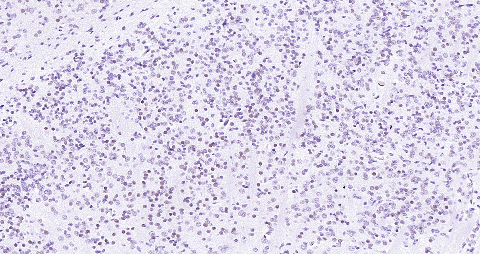 Paraformaldehyde-fixed, paraffin embedded (rat fetal brain); Antigen retrieval by boiling in sodium citrate buffer (pH6.0) for 15min; Block endogenous peroxidase by 3% hydrogen peroxide for 20 minutes; Blocking buffer (normal goat serum) at 37°C for 30min; Antibody incubation with (LMX1b) Polyclonal Antibody, Unconjugated (bs-11780R) at 1:200 overnight at 4°C, followed by operating according to SP Kit(Rabbit) (sp-0023) instructionsand DAB staining.