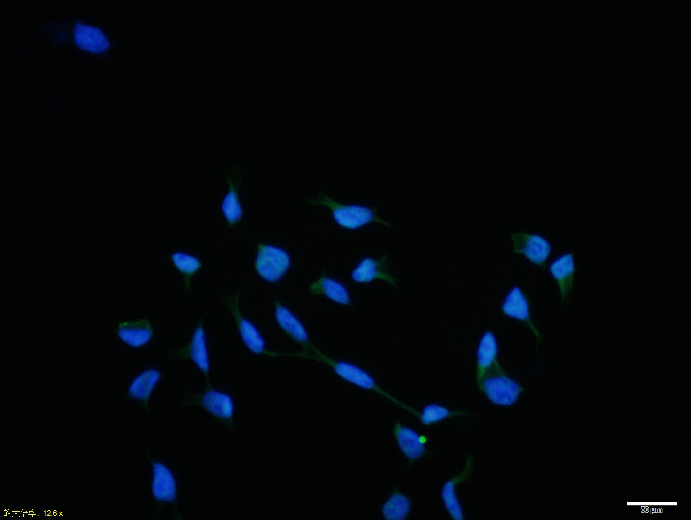 Hela cell; 4% Paraformaldehyde-fixed; Triton X-100 at room temperature for 20 min; Blocking buffer (normal goat serum, C-0005) at 37°C for 20 min; Antibody incubation with (KDM1/LSD1) polyclonal Antibody, Unconjugated (bs-10166R) 1:100, 90 minutes at 37°C; followed by a conjugated Goat Anti-Rabbit IgG antibody at 37°C for 90 minutes, DAPI (blue, C02-04002) was used to stain the cell nuclei.