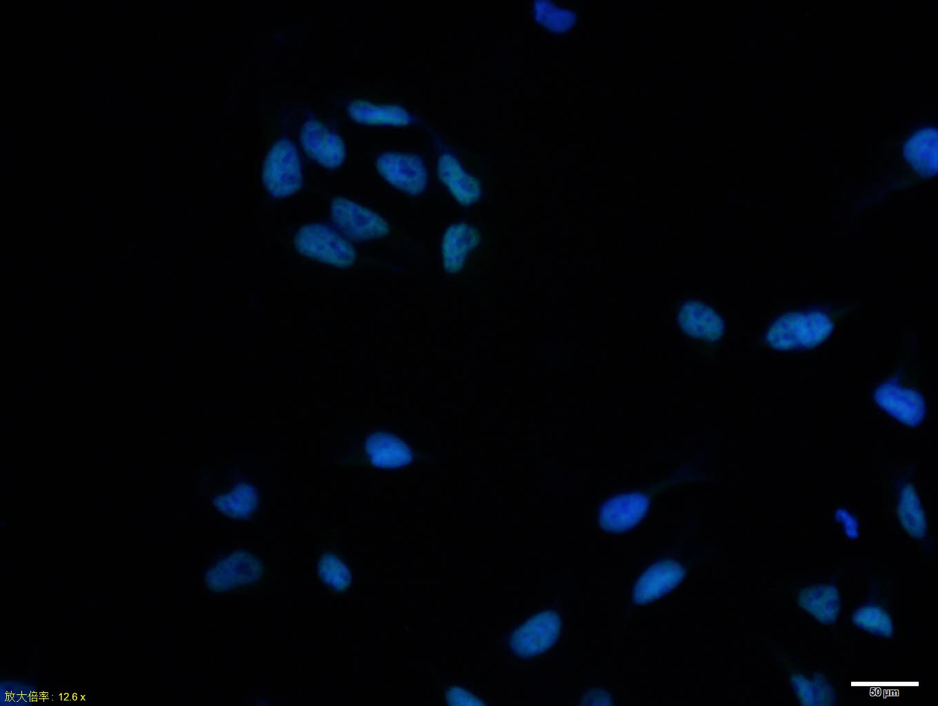 Hela cell; 4% Paraformaldehyde-fixed; Triton X-100 at room temperature for 20 min; Blocking buffer (normal goat serum, C-0005) at 37°C for 20 min; Antibody incubation with (Histone H4 (Acetyl K5)) polyclonal Antibody, Unconjugated (bs-10721R) 1:100, 90 minutes at 37°C; followed by a conjugated Goat Anti-Rabbit IgG antibody at 37°C for 90 minutes, DAPI (blue, C02-04002) was used to stain the cell nuclei.
