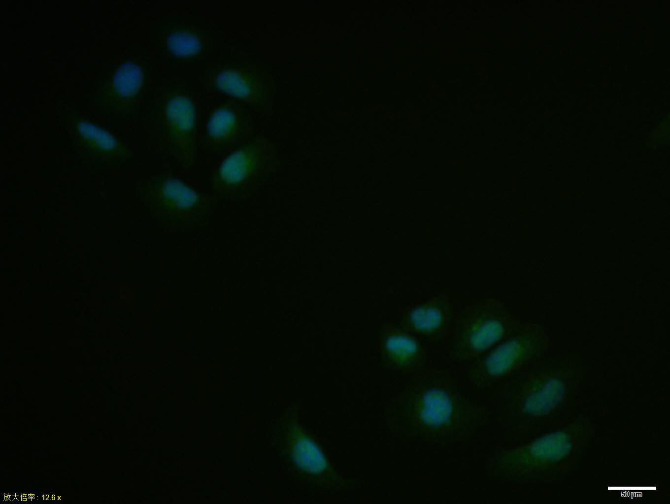 Hela cell; 4% Paraformaldehyde-fixed; Triton X-100 at room temperature for 20 min; Blocking buffer (normal goat serum, C-0005) at 37°C for 20 min; Antibody incubation with (SKP2) polyclonal Antibody, Unconjugated (bs-1096R) 1:100, 90 minutes at 37°C; followed by a conjugated Goat Anti-Rabbit IgG antibody at 37°C for 90 minutes, DAPI (blue, C02-04002) was used to stain the cell nuclei.