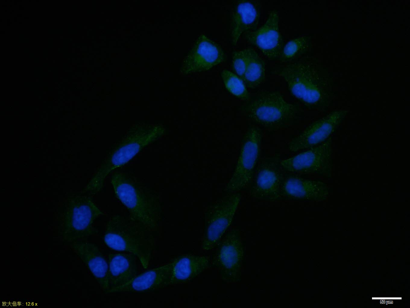 Hela cell; 4% Paraformaldehyde-fixed; Triton X-100 at room temperature for 20 min; Blocking buffer (normal goat serum, C-0005) at 37\u00b0C for 20 min; Antibody incubation with (STAT5) polyclonal Antibody, Unconjugated (bs-1142R) 1:100, 90 minutes at 37\u00b0C; followed by a conjugated Goat Anti-Rabbit IgG antibody at 37\u00b0C for 90 minutes, DAPI (blue, C02-04002) was used to stain the cell nuclei.