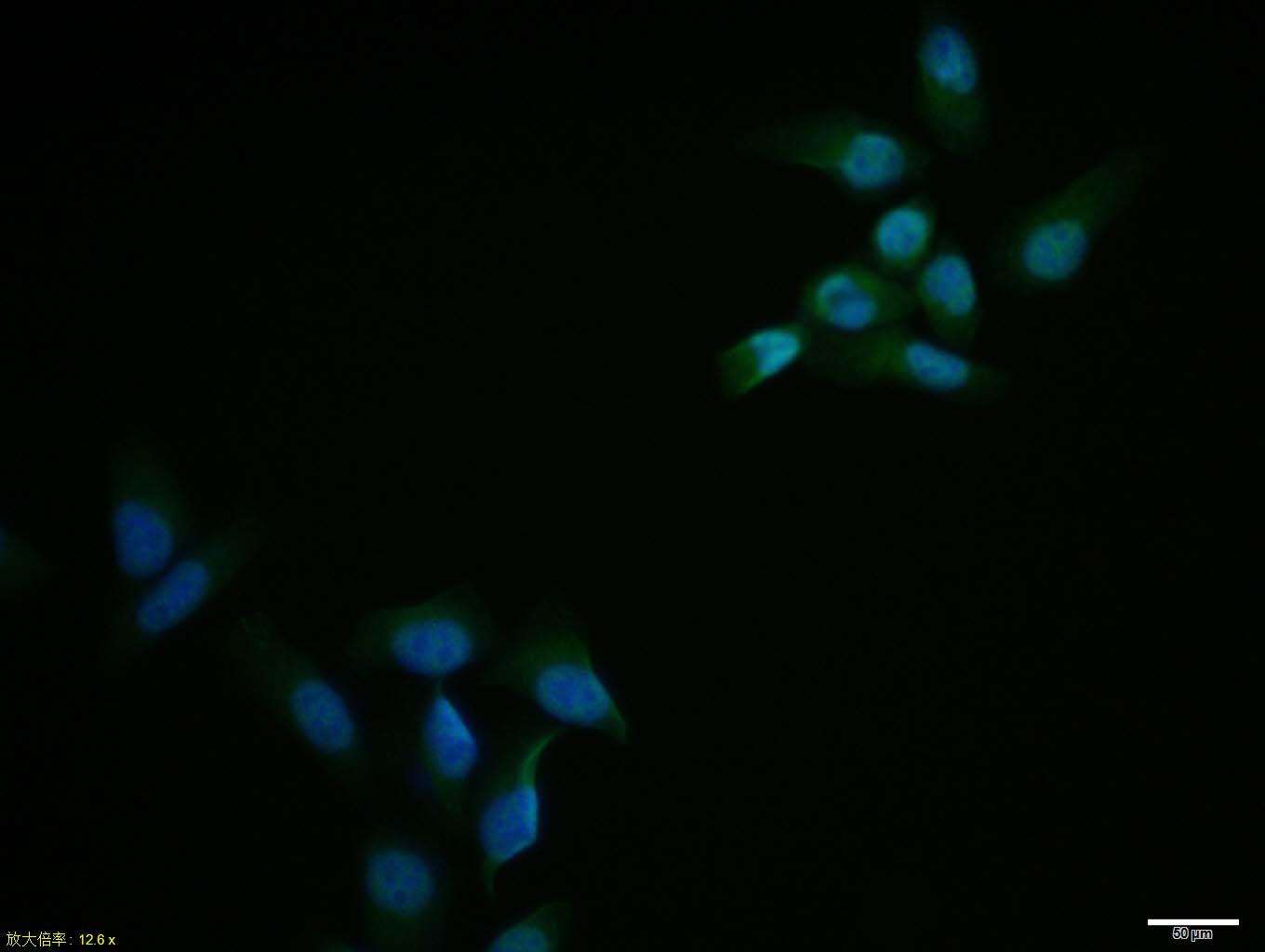 Hela cell; 4% Paraformaldehyde-fixed; Triton X-100 at room temperature for 20 min; Blocking buffer (normal goat serum, C-0005) at 37°C for 20 min; Antibody incubation with (MAPK4) polyclonal Antibody, Unconjugated (bs-1319R) 1:100, 90 minutes at 37°C; followed by a conjugated Goat Anti-Rabbit IgG antibody at 37°C for 90 minutes, DAPI (blue, C02-04002) was used to stain the cell nuclei.