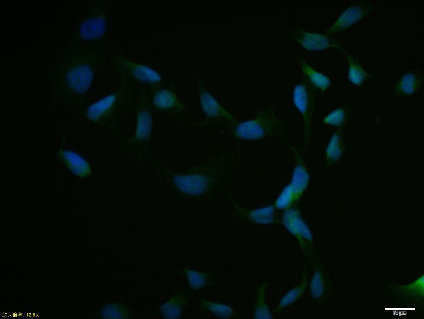 Hela cell; 4% Paraformaldehyde-fixed; Triton X-100 at room temperature for 20 min; Blocking buffer (normal goat serum, C-0005) at 37°C for 20 min; Antibody incubation with (NRF1) polyclonal Antibody, Unconjugated (bs-1342R) 1:100, 90 minutes at 37°C; followed by a conjugated Goat Anti-Rabbit IgG antibody at 37°C for 90 minutes, DAPI (blue, C02-04002) was used to stain the cell nuclei.