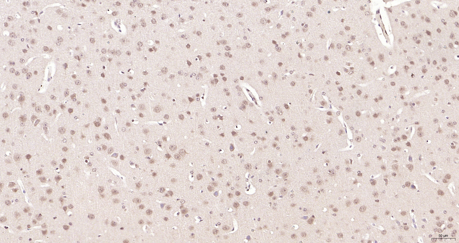 Paraformaldehyde-fixed, paraffin embedded (mouse brain); Antigen retrieval by boiling in sodium citrate buffer (pH6.0) for 15min; Block endogenous peroxidase by 3% hydrogen peroxide for 20 minutes; Blocking buffer (normal goat serum) at 37°C for 30min; Antibody incubation with (CWC22) Polyclonal Antibody, Unconjugated (bs-11464R) at 1:200 overnight at 4°C, followed by operating according to SP Kit(Rabbit) (sp-0023) instructionsand DAB staining.
