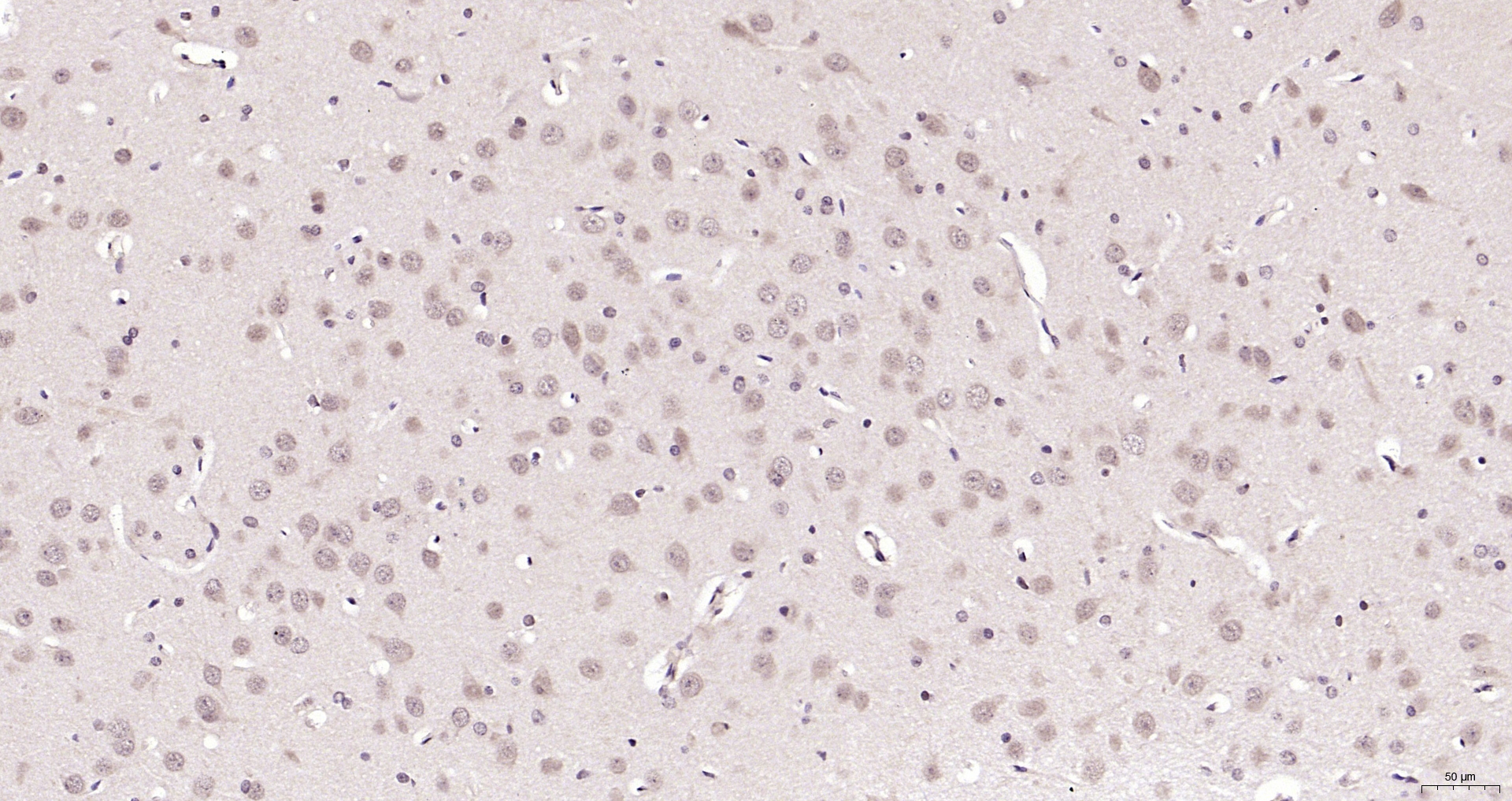 Paraformaldehyde-fixed, paraffin embedded (rat brain); Antigen retrieval by boiling in sodium citrate buffer (pH6.0) for 15min; Block endogenous peroxidase by 3% hydrogen peroxide for 20 minutes; Blocking buffer (normal goat serum) at 37°C for 30min; Antibody incubation with (CWC22) Polyclonal Antibody, Unconjugated (bs-11464R) at 1:200 overnight at 4°C, followed by operating according to SP Kit(Rabbit) (sp-0023) instructionsand DAB staining.