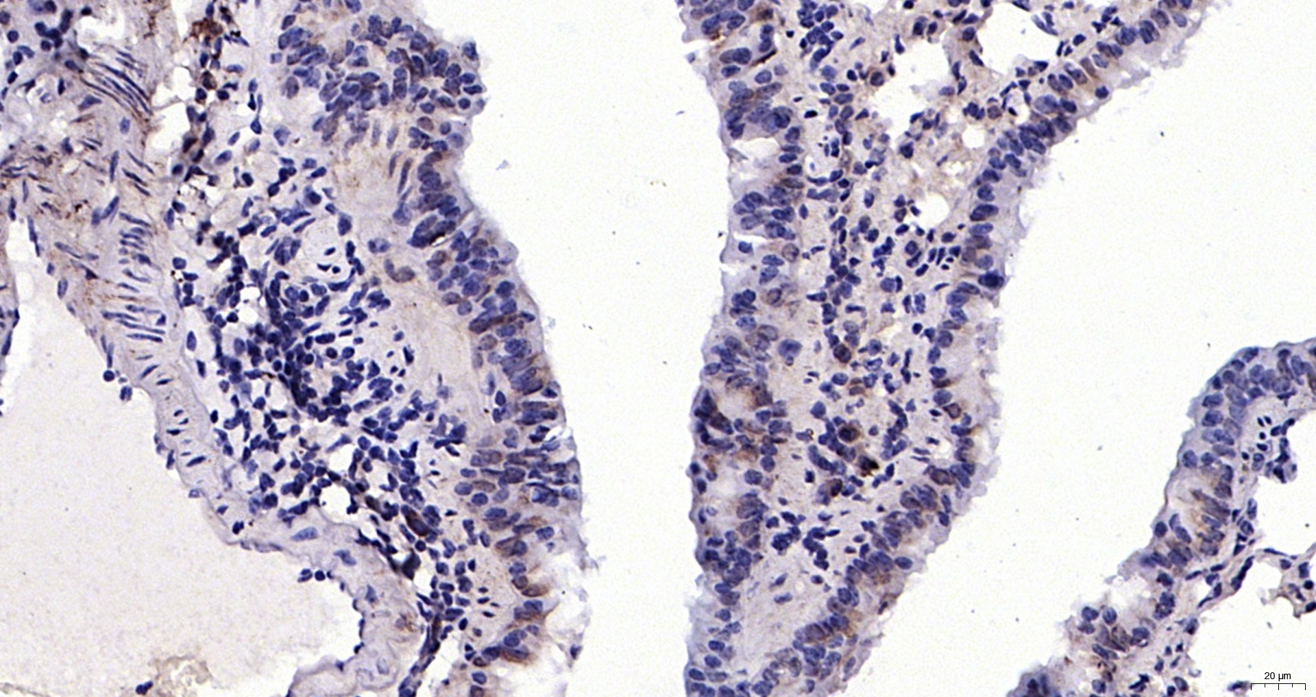 Paraformaldehyde-fixed, paraffin embedded (mouse lung); Antigen retrieval by boiling in sodium citrate buffer (pH6.0) for 15min; Block endogenous peroxidase by 3% hydrogen peroxide for 20 minutes; Blocking buffer (normal goat serum) at 37°C for 30min; Antibody incubation with (Calcipressin 3) Polyclonal Antibody, Unconjugated (bs-11542R) at 1:200 overnight at 4°C, followed by operating according to SP Kit(Rabbit) (sp-0023) instructionsand DAB staining.