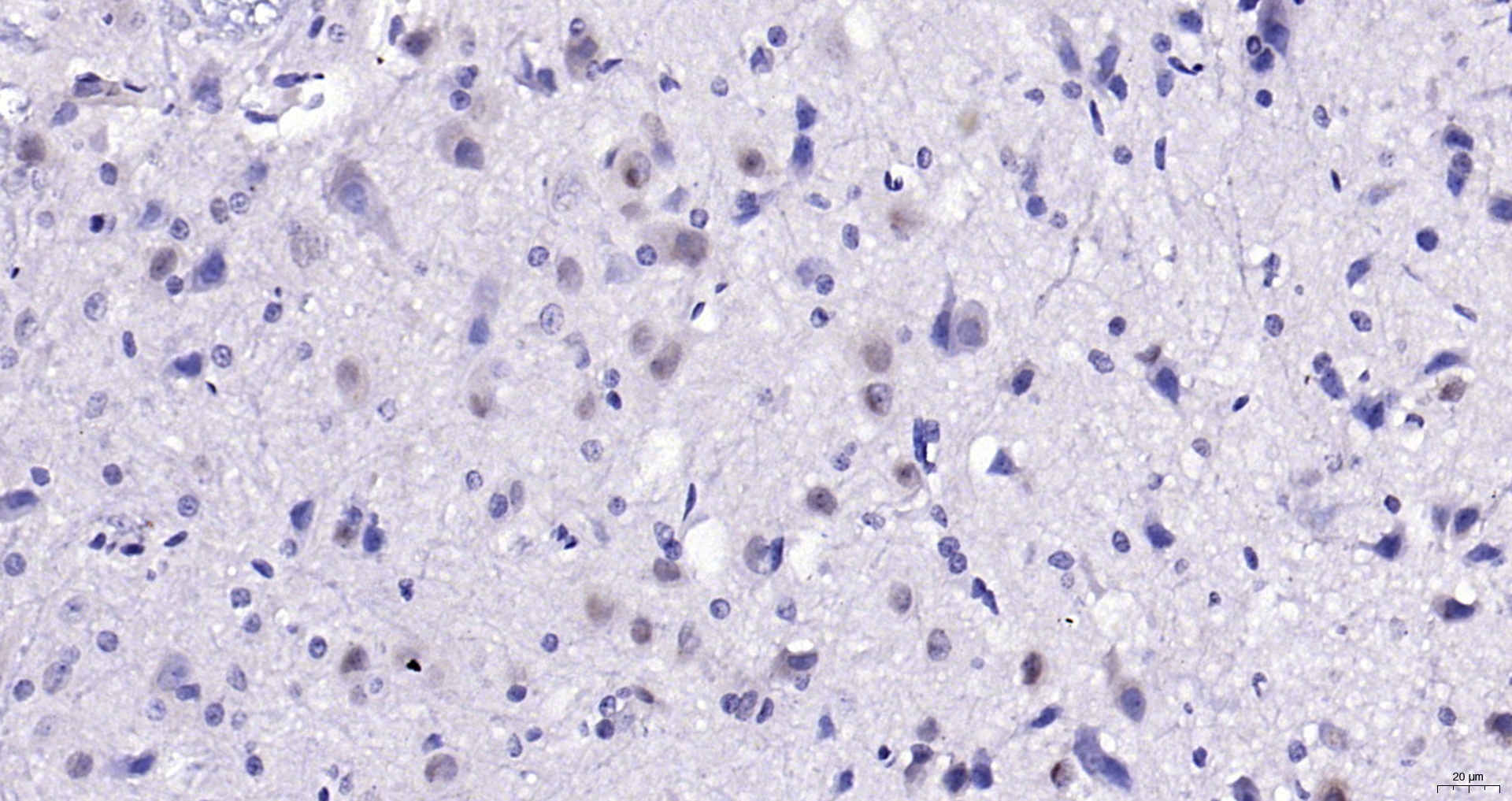 Paraformaldehyde-fixed, paraffin embedded (rat cerebellum); Antigen retrieval by boiling in sodium citrate buffer (pH6.0) for 15min; Block endogenous peroxidase by 3% hydrogen peroxide for 20 minutes; Blocking buffer (normal goat serum) at 37°C for 30min; Antibody incubation with (Ctip1) Polyclonal Antibody, Unconjugated (bs-11544R) at 1:200 overnight at 4°C, followed by operating according to SP Kit(Rabbit) (sp-0023) instructionsand DAB staining.