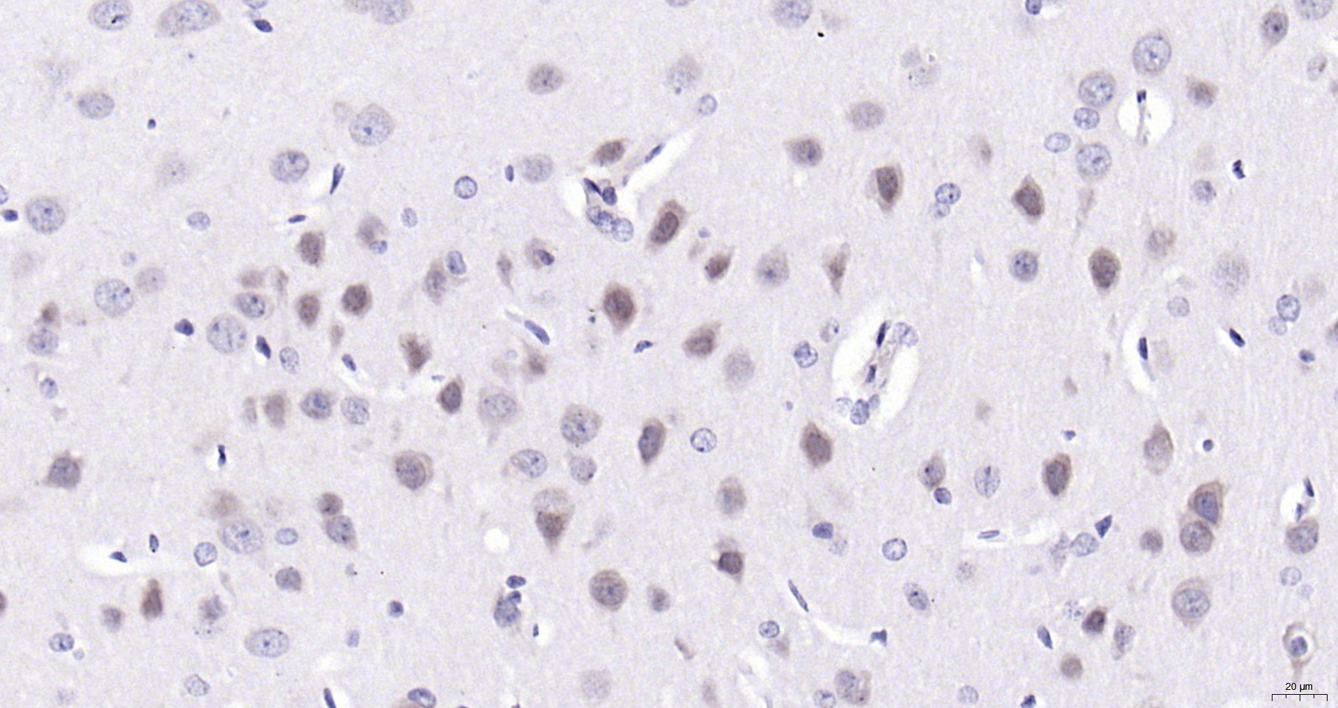 Paraformaldehyde-fixed, paraffin embedded (rat brain); Antigen retrieval by boiling in sodium citrate buffer (pH6.0) for 15min; Block endogenous peroxidase by 3% hydrogen peroxide for 20 minutes; Blocking buffer (normal goat serum) at 37°C for 30min; Antibody incubation with (Ctip1) Polyclonal Antibody, Unconjugated (bs-11544R) at 1:200 overnight at 4°C, followed by operating according to SP Kit(Rabbit) (sp-0023) instructionsand DAB staining.