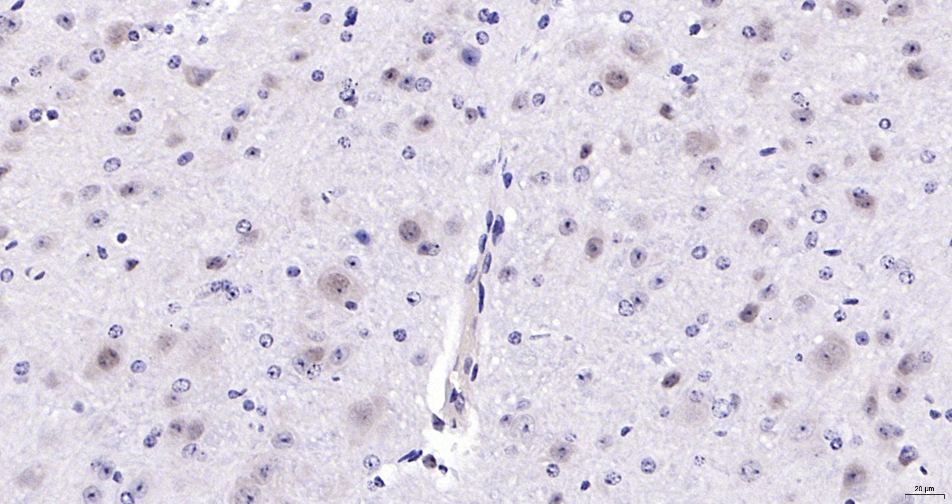 Paraformaldehyde-fixed, paraffin embedded (mouse brain); Antigen retrieval by boiling in sodium citrate buffer (pH6.0) for 15min; Block endogenous peroxidase by 3% hydrogen peroxide for 20 minutes; Blocking buffer (normal goat serum) at 37°C for 30min; Antibody incubation with (Ctip1) Polyclonal Antibody, Unconjugated (bs-11544R) at 1:200 overnight at 4°C, followed by operating according to SP Kit(Rabbit) (sp-0023) instructionsand DAB staining.