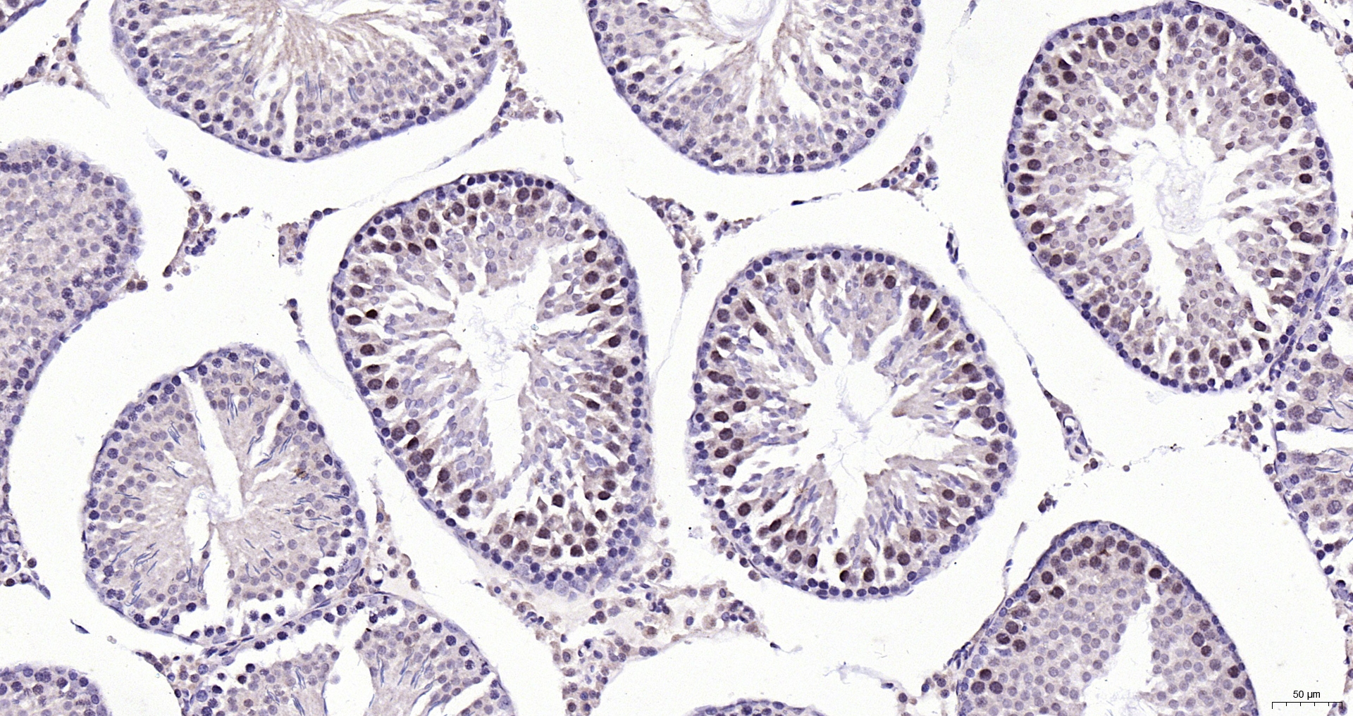 Paraformaldehyde-fixed, paraffin embedded (rat testis); Antigen retrieval by boiling in sodium citrate buffer (pH6.0) for 15min; Block endogenous peroxidase by 3% hydrogen peroxide for 20 minutes; Blocking buffer (normal goat serum) at 37°C for 30min; Antibody incubation with (Gemin 2) Polyclonal Antibody, Unconjugated (bs-11562R) at 1:200 overnight at 4°C, followed by operating according to SP Kit(Rabbit) (sp-0023) instructionsand DAB staining.