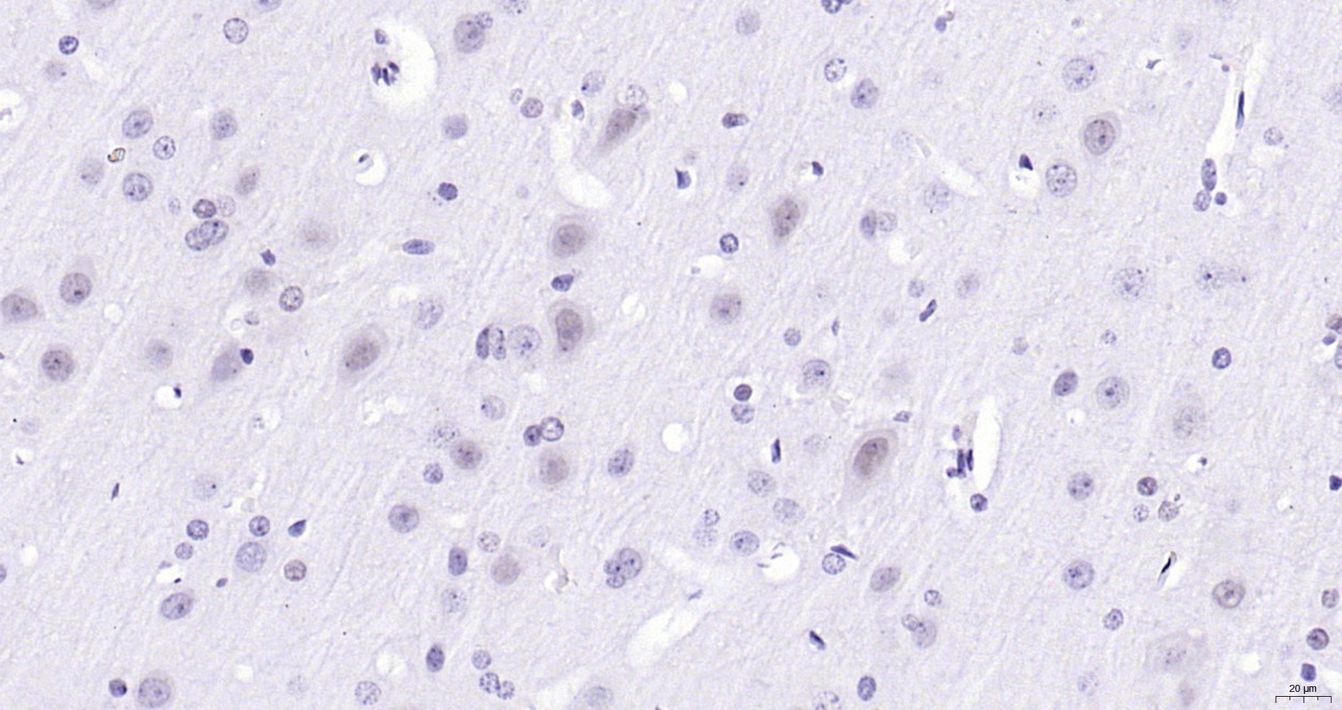 Paraformaldehyde-fixed, paraffin embedded (rat brain); Antigen retrieval by boiling in sodium citrate buffer (pH6.0) for 15min; Block endogenous peroxidase by 3% hydrogen peroxide for 20 minutes; Blocking buffer (normal goat serum) at 37°C for 30min; Antibody incubation with (Gemin 2) Polyclonal Antibody, Unconjugated (bs-11562R) at 1:200 overnight at 4°C, followed by operating according to SP Kit(Rabbit) (sp-0023) instructionsand DAB staining.