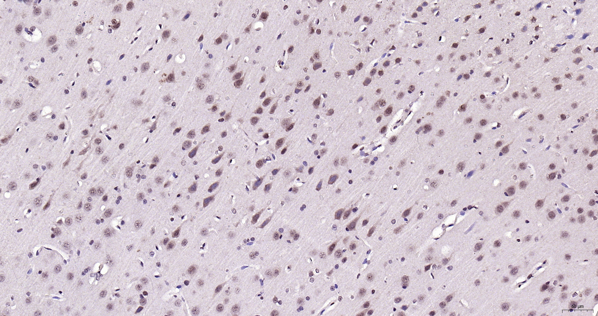 Paraformaldehyde-fixed, paraffin embedded (rat brain); Antigen retrieval by boiling in sodium citrate buffer (pH6.0) for 15min; Block endogenous peroxidase by 3% hydrogen peroxide for 20 minutes; Blocking buffer (normal goat serum) at 37°C for 30min; Antibody incubation with (Neuro D) Polyclonal Antibody, Unconjugated (bs-11573R) at 1:200 overnight at 4°C, followed by operating according to SP Kit(Rabbit) (sp-0023) instructionsand DAB staining.