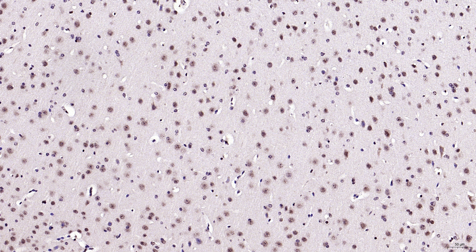 Paraformaldehyde-fixed, paraffin embedded (mouse brain); Antigen retrieval by boiling in sodium citrate buffer (pH6.0) for 15min; Block endogenous peroxidase by 3% hydrogen peroxide for 20 minutes; Blocking buffer (normal goat serum) at 37°C for 30min; Antibody incubation with (Neuro D) Polyclonal Antibody, Unconjugated (bs-11573R) at 1:200 overnight at 4°C, followed by operating according to SP Kit(Rabbit) (sp-0023) instructionsand DAB staining.