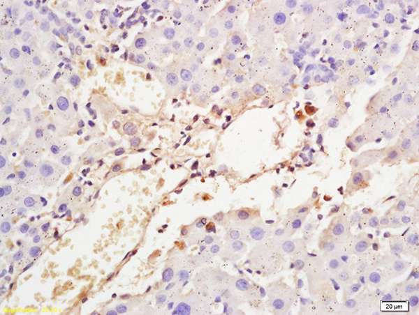 Formalin-fixed and paraffin embedded rat liver tissue labeled with Anti-Transferrin Polyclonal Antibody, Unconjugated (bs-2052R) at 1:200 followed by conjugation to the secondary antibody and DAB staining Formalin-fixed and paraffin embedded rat liver tissue labeled with Anti-Transferrin Polyclonal Antibody, Unconjugated (bs-2052R) at 1:200 followed by conjugation to the secondary antibody and DAB staining