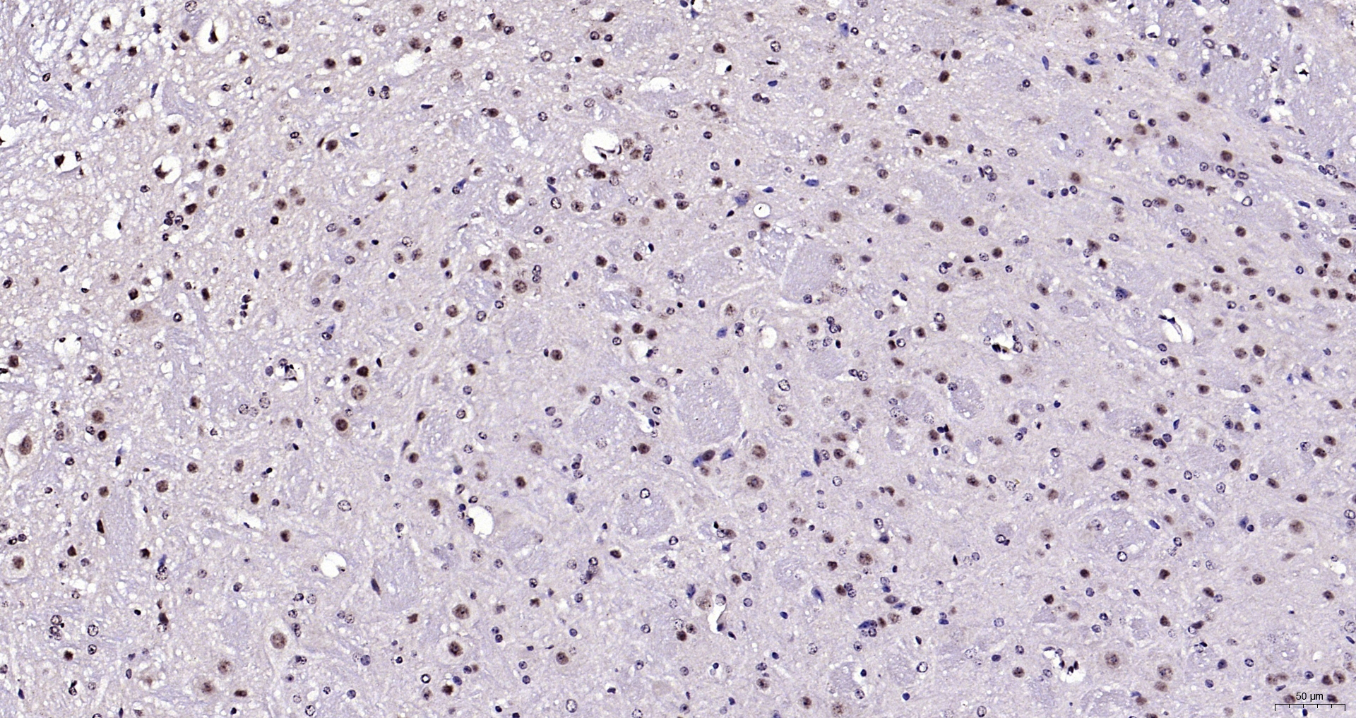 Paraformaldehyde-fixed, paraffin embedded (mouse cerebellum); Antigen retrieval by boiling in sodium citrate buffer (pH6.0) for 15min; Block endogenous peroxidase by 3% hydrogen peroxide for 20 minutes; Blocking buffer (normal goat serum) at 37°C for 30min; Antibody incubation with (Neuro D) Polyclonal Antibody, Unconjugated (bs-11573R) at 1:200 overnight at 4°C, followed by operating according to SP Kit(Rabbit) (sp-0023) instructionsand DAB staining.