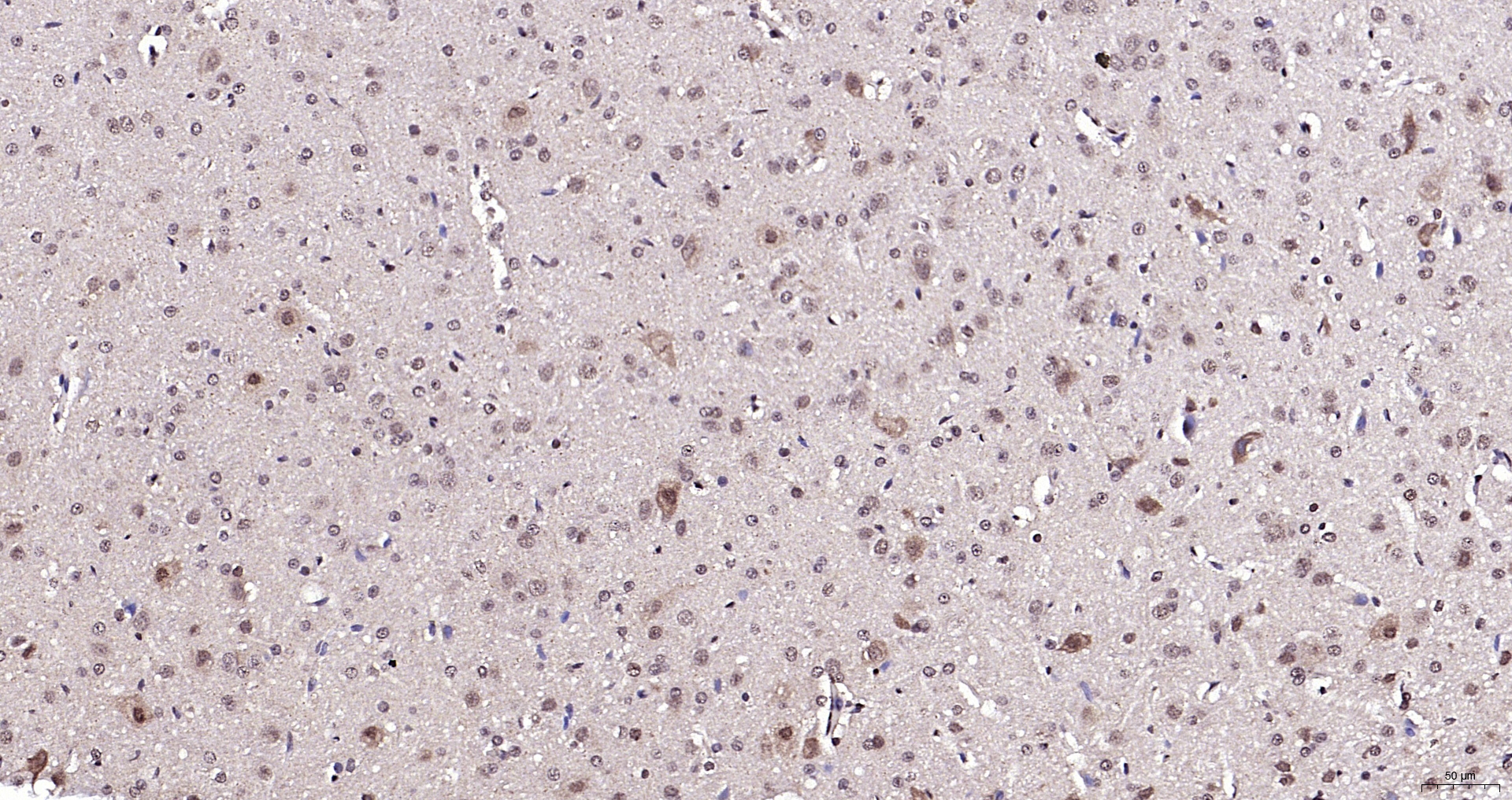 Paraformaldehyde-fixed, paraffin embedded (rat cerebellum); Antigen retrieval by boiling in sodium citrate buffer (pH6.0) for 15min; Block endogenous peroxidase by 3% hydrogen peroxide for 20 minutes; Blocking buffer (normal goat serum) at 37°C for 30min; Antibody incubation with (Neuro D) Polyclonal Antibody, Unconjugated (bs-11573R) at 1:200 overnight at 4°C, followed by operating according to SP Kit(Rabbit) (sp-0023) instructionsand DAB staining.