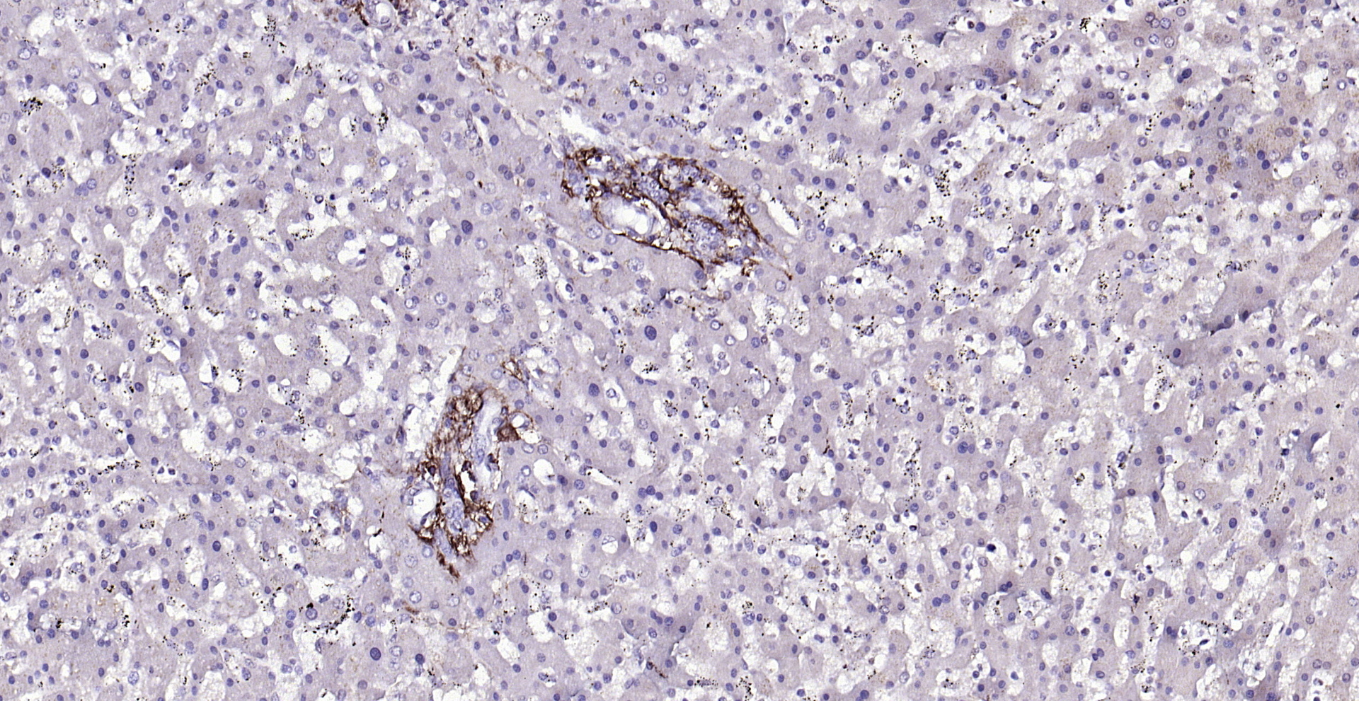 Paraformaldehyde-fixed, paraffin embedded (human liver); Antigen retrieval by boiling in sodium citrate buffer (pH6.0) for 15min; Block endogenous peroxidase by 3% hydrogen peroxide for 20 minutes; Blocking buffer (normal goat serum) at 37°C for 30min; Antibody incubation with (CYB5R3) Polyclonal Antibody, Unconjugated (bs-12162R) at 1:200 overnight at 4°C, followed by operating according to SP Kit(Rabbit) (sp-0023) instructionsand DAB staining. Paraformaldehyde-fixed, paraffin embedded (human liver); Antigen retrieval by boiling in sodium citrate buffer (pH6.0) for 15min; Block endogenous peroxidase by 3% hydrogen peroxide for 20 minutes; Blocking buffer (normal goat serum) at 37°C for 30min; Antibody incubation with (CYB5R3) Polyclonal Antibody, Unconjugated (bs-12162R) at 1:200 overnight at 4°C, followed by operating according to SP Kit(Rabbit) (sp-0023) instructionsand DAB staining.