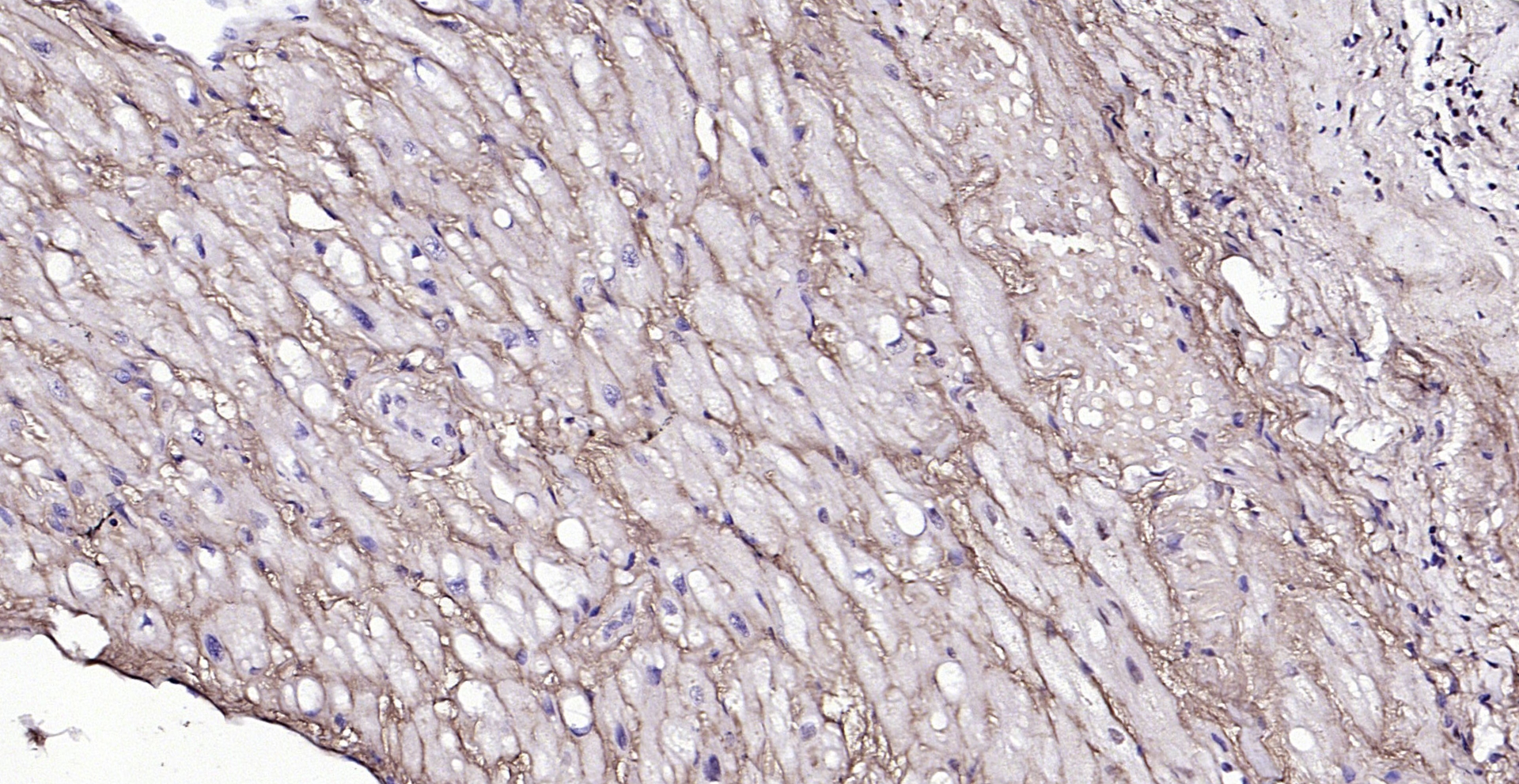 Paraformaldehyde-fixed, paraffin embedded (human myocardium); Antigen retrieval by boiling in sodium citrate buffer (pH6.0) for 15min; Block endogenous peroxidase by 3% hydrogen peroxide for 20 minutes; Blocking buffer (normal goat serum) at 37°C for 30min; Antibody incubation with (CYB5R3) Polyclonal Antibody, Unconjugated (bs-12162R) at 1:200 overnight at 4°C, followed by operating according to SP Kit(Rabbit) (sp-0023) instructionsand DAB staining. Paraformaldehyde-fixed, paraffin embedded (human myocardium); Antigen retrieval by boiling in sodium citrate buffer (pH6.0) for 15min; Block endogenous peroxidase by 3% hydrogen peroxide for 20 minutes; Blocking buffer (normal goat serum) at 37°C for 30min; Antibody incubation with (CYB5R3) Polyclonal Antibody, Unconjugated (bs-12162R) at 1:200 overnight at 4°C, followed by operating according to SP Kit(Rabbit) (sp-0023) instructionsand DAB staining.