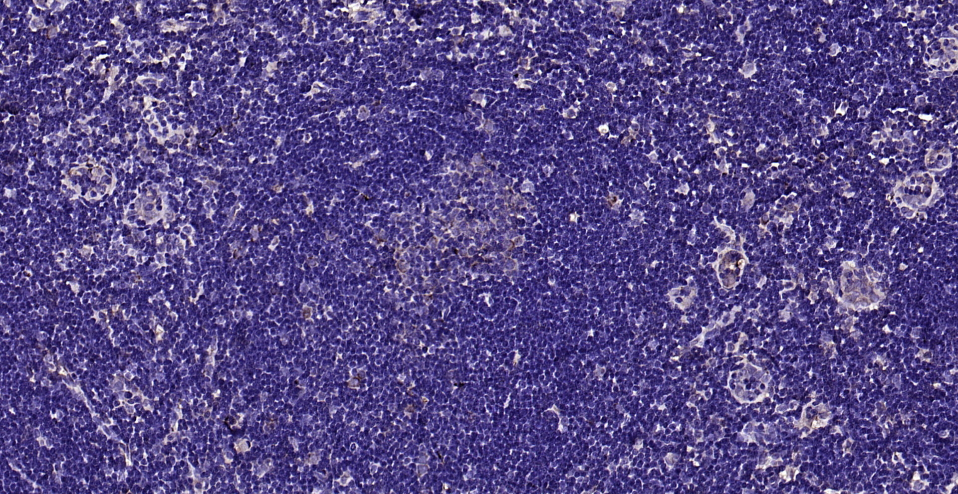 Paraformaldehyde-fixed, paraffin embedded (rat lymphoid); Antigen retrieval by boiling in sodium citrate buffer (pH6.0) for 15min; Block endogenous peroxidase by 3% hydrogen peroxide for 20 minutes; Blocking buffer (normal goat serum) at 37°C for 30min; Antibody incubation with (FLVCR) Polyclonal Antibody, Unconjugated (bs-12344R) at 1:200 overnight at 4°C, followed by operating according to SP Kit(Rabbit) (sp-0023) instructionsand DAB staining.