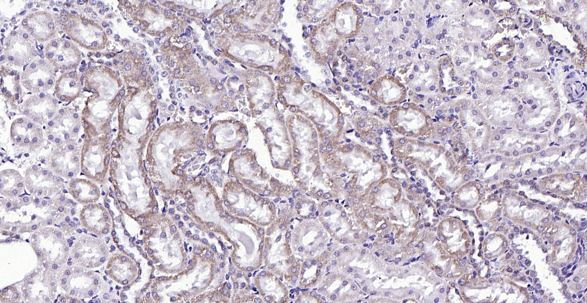 Paraformaldehyde-fixed, paraffin embedded (rat kidney); Antigen retrieval by boiling in sodium citrate buffer (pH6.0) for 15min; Block endogenous peroxidase by 3% hydrogen peroxide for 20 minutes; Blocking buffer (normal goat serum) at 37°C for 30min; Antibody incubation with (FLVCR) Polyclonal Antibody, Unconjugated (bs-12344R) at 1:200 overnight at 4°C, followed by operating according to SP Kit(Rabbit) (sp-0023) instructionsand DAB staining.