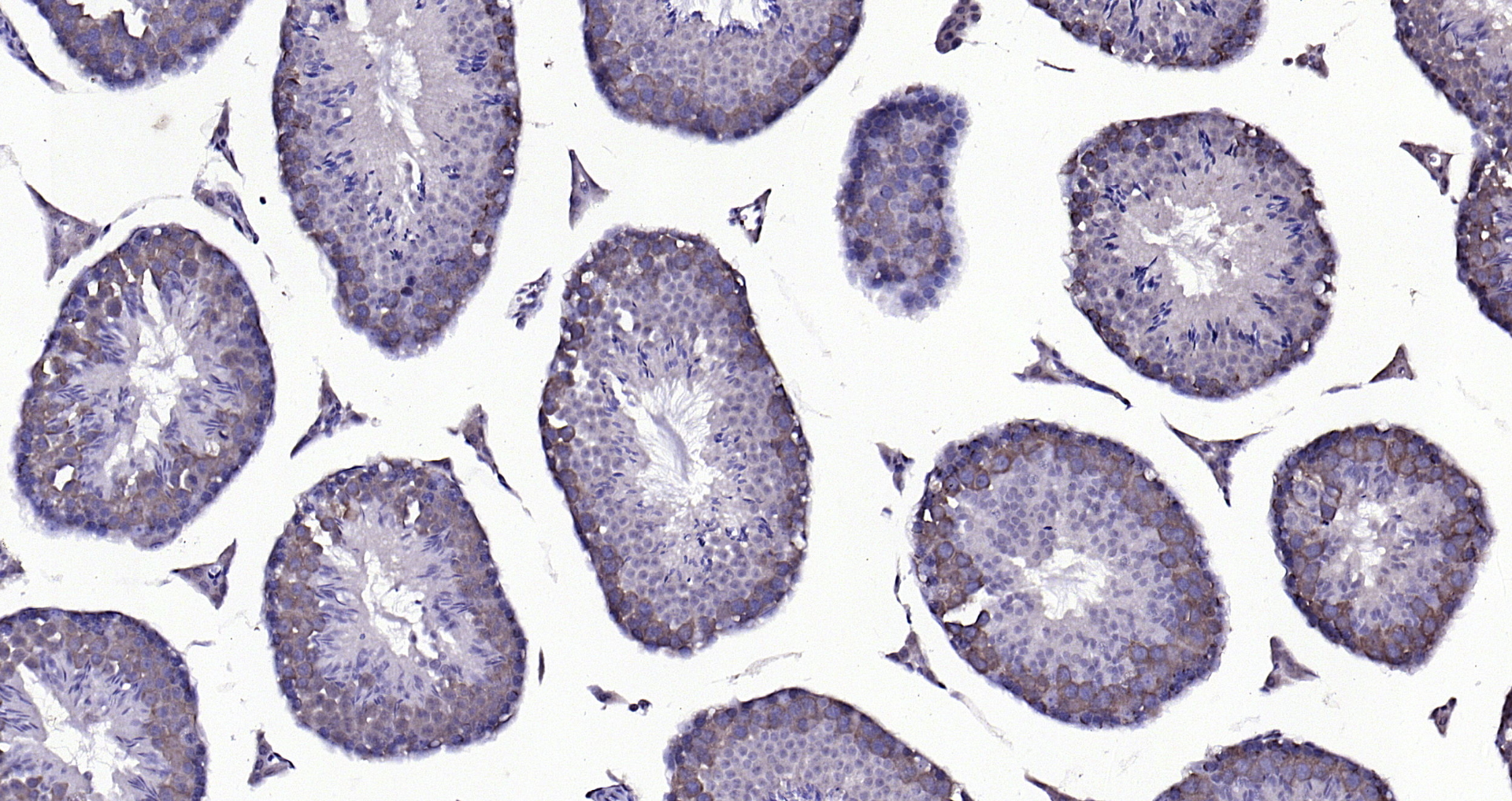 Paraformaldehyde-fixed, paraffin embedded (mouse testis); Antigen retrieval by boiling in sodium citrate buffer (pH6.0) for 15min; Block endogenous peroxidase by 3% hydrogen peroxide for 20 minutes; Blocking buffer (normal goat serum) at 37°C for 30min; Antibody incubation with (Beta arrestin 2) Polyclonal Antibody, Unconjugated (bs-1332R) at 1:200 overnight at 4°C, followed by operating according to SP Kit(Rabbit) (sp-0023) instructionsand DAB staining. Paraformaldehyde-fixed, paraffin embedded (mouse testis); Antigen retrieval by boiling in sodium citrate buffer (pH6.0) for 15min; Block endogenous peroxidase by 3% hydrogen peroxide for 20 minutes; Blocking buffer (normal goat serum) at 37°C for 30min; Antibody incubation with (Beta arrestin 2) Polyclonal Antibody, Unconjugated (bs-1332R) at 1:200 overnight at 4°C, followed by operating according to SP Kit(Rabbit) (sp-0023) instructionsand DAB staining.